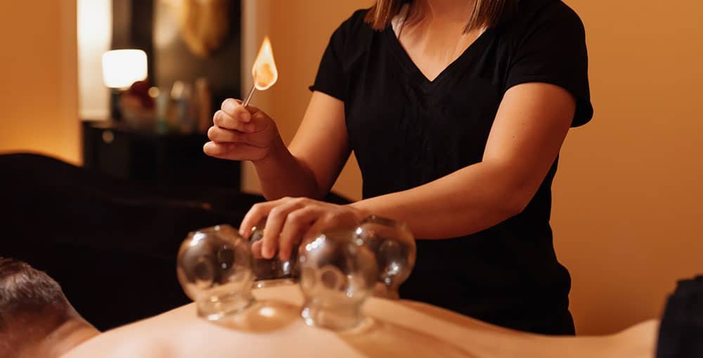 What Is Cupping & Can Cupping Therapy Help