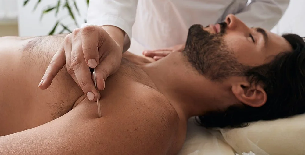 How Acupuncture Helps You Thrive: Is It Right for You?