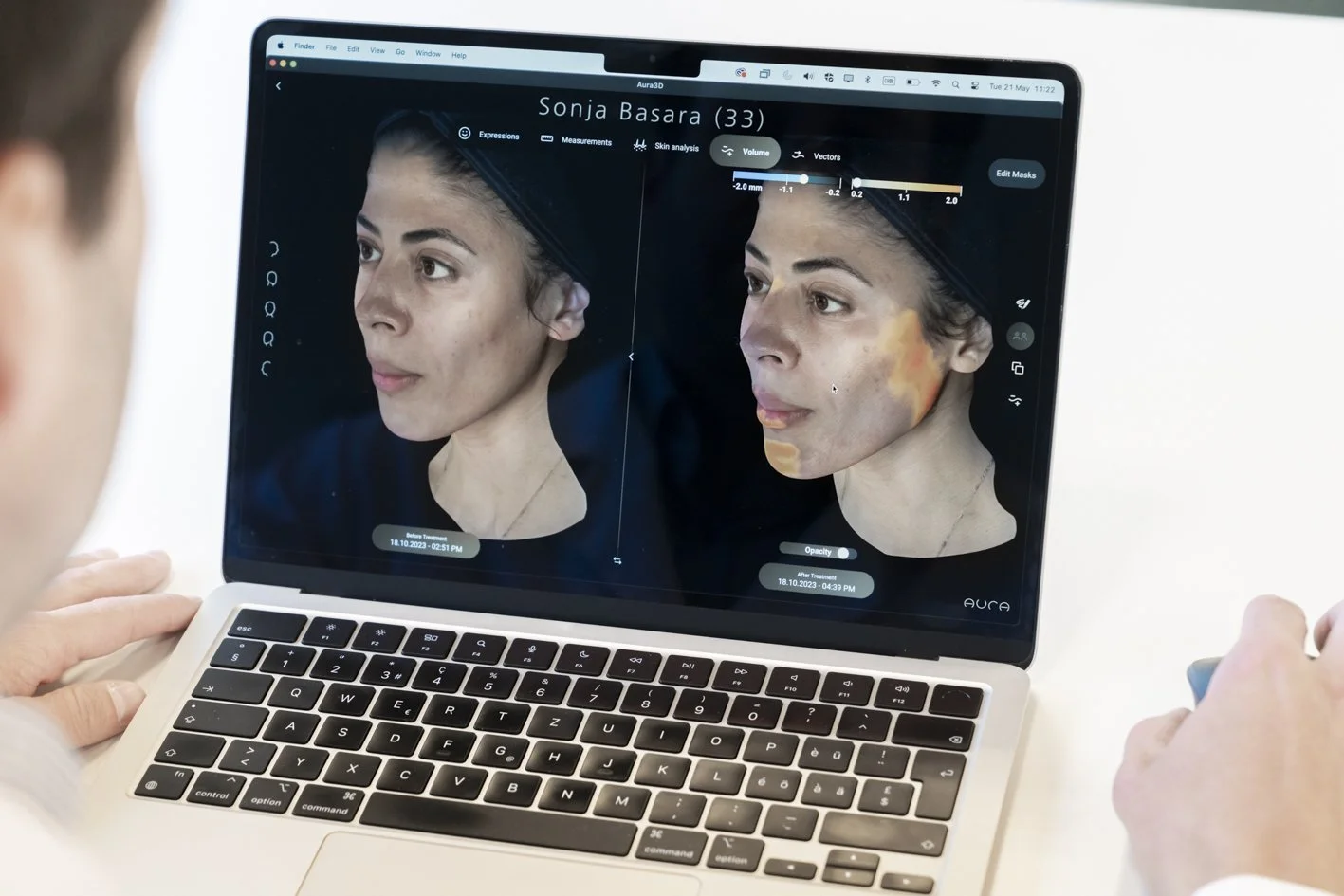 Why I Believe 3D AI Photo Mapping is the Future of Aesthetics