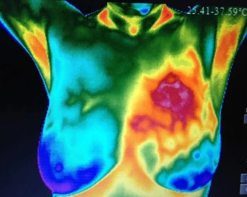 Thermography