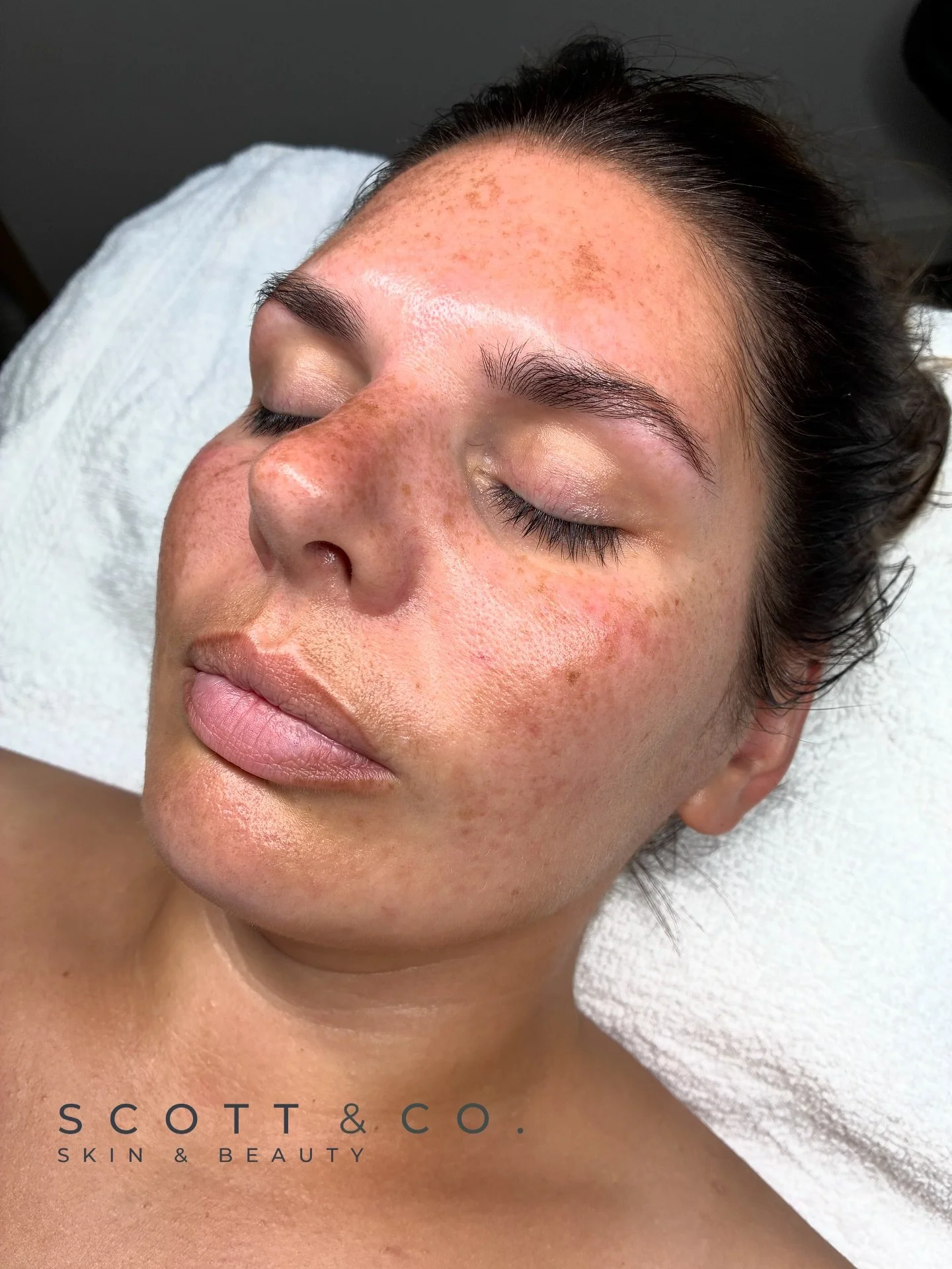 Final skin appointment for this beautiful bride to be 👰

I have worked with Mikayla over the last 6 months to prepare her skin for her happy day. But more on that later&hellip;

For her final appointment just a few days before her wedding we kept th