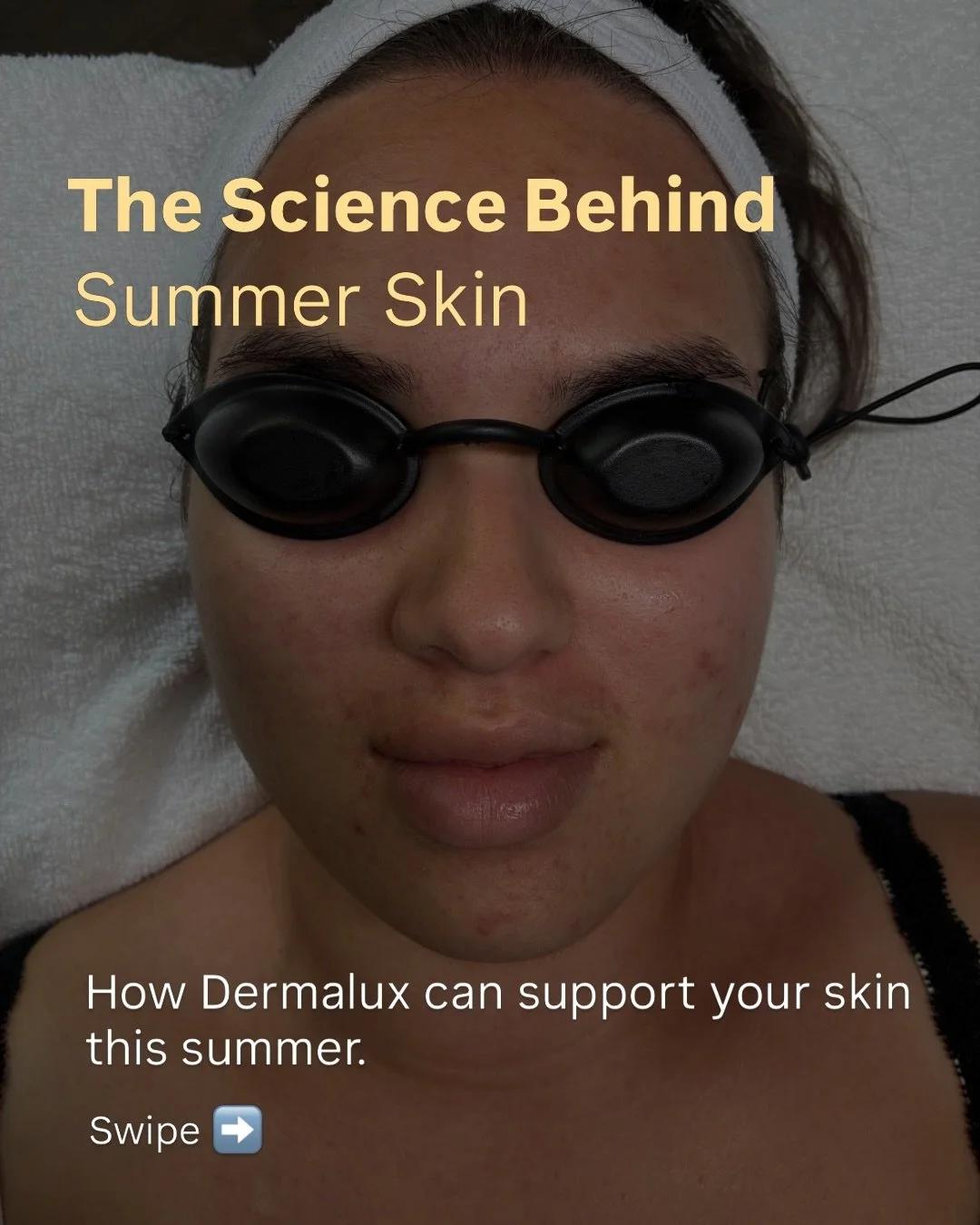 Summer presents a unique set of challenges for the skin.

Increased UV exposure, heat and humidity can all contribute to pigmentation, congestion and inflammation.

Dermalux LED uses clinically proven light wavelengths to support the skin at a cellul