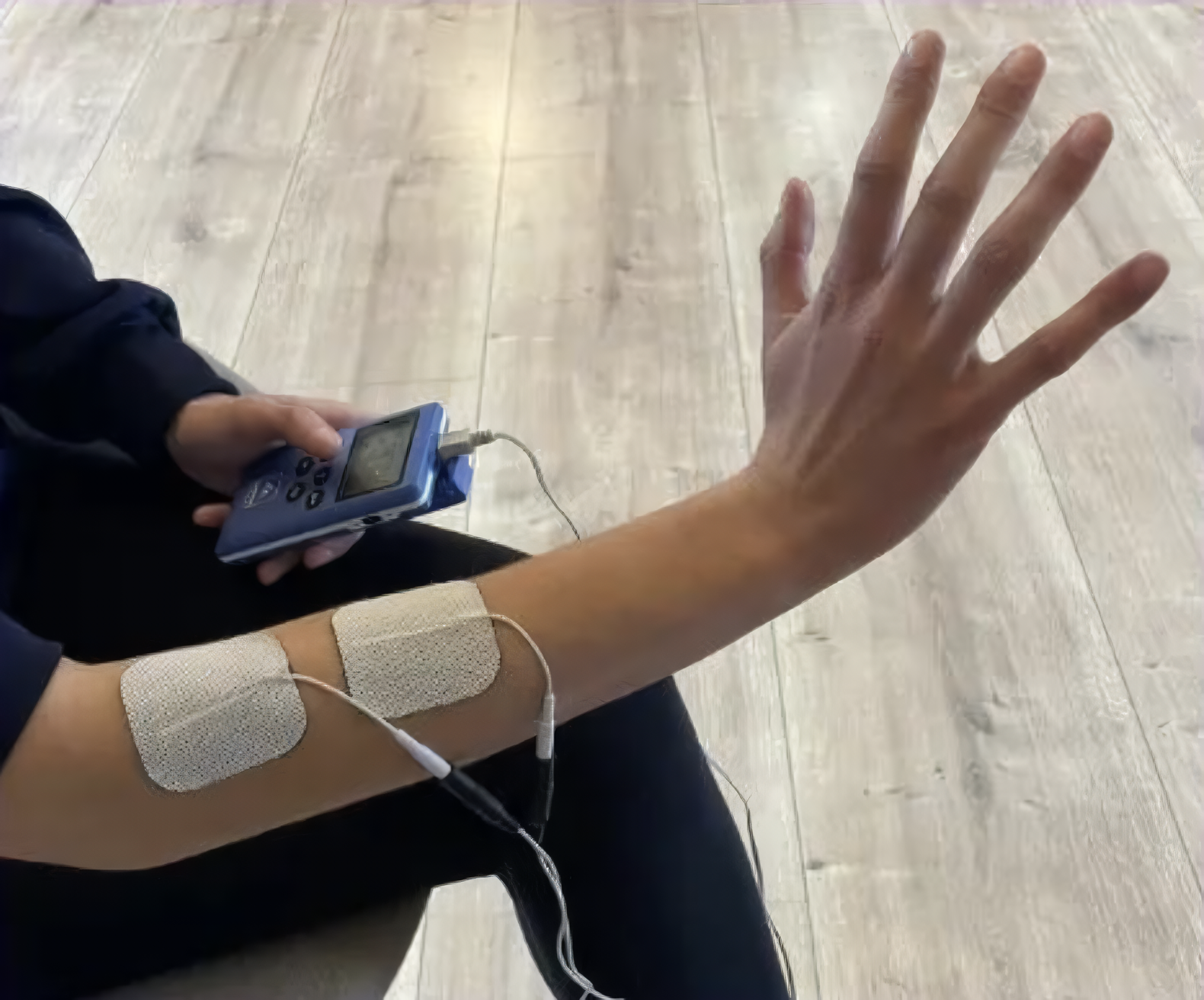 A child has an electrical stimulation device attached to his right arm