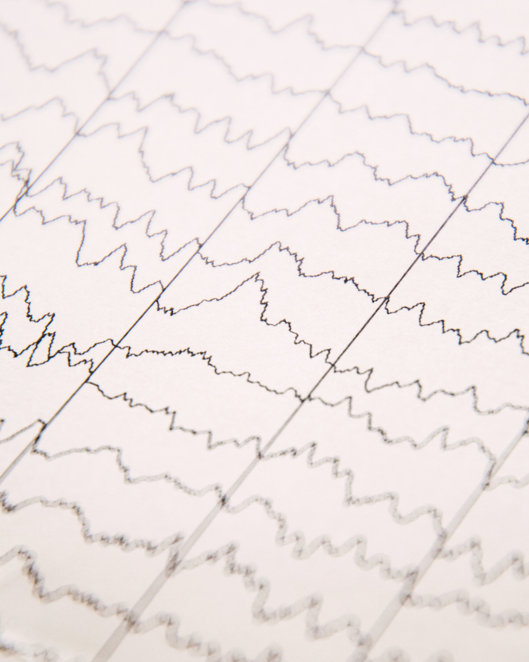 🧠 Les ondes cérébrales : la base de la base du neurofeedback