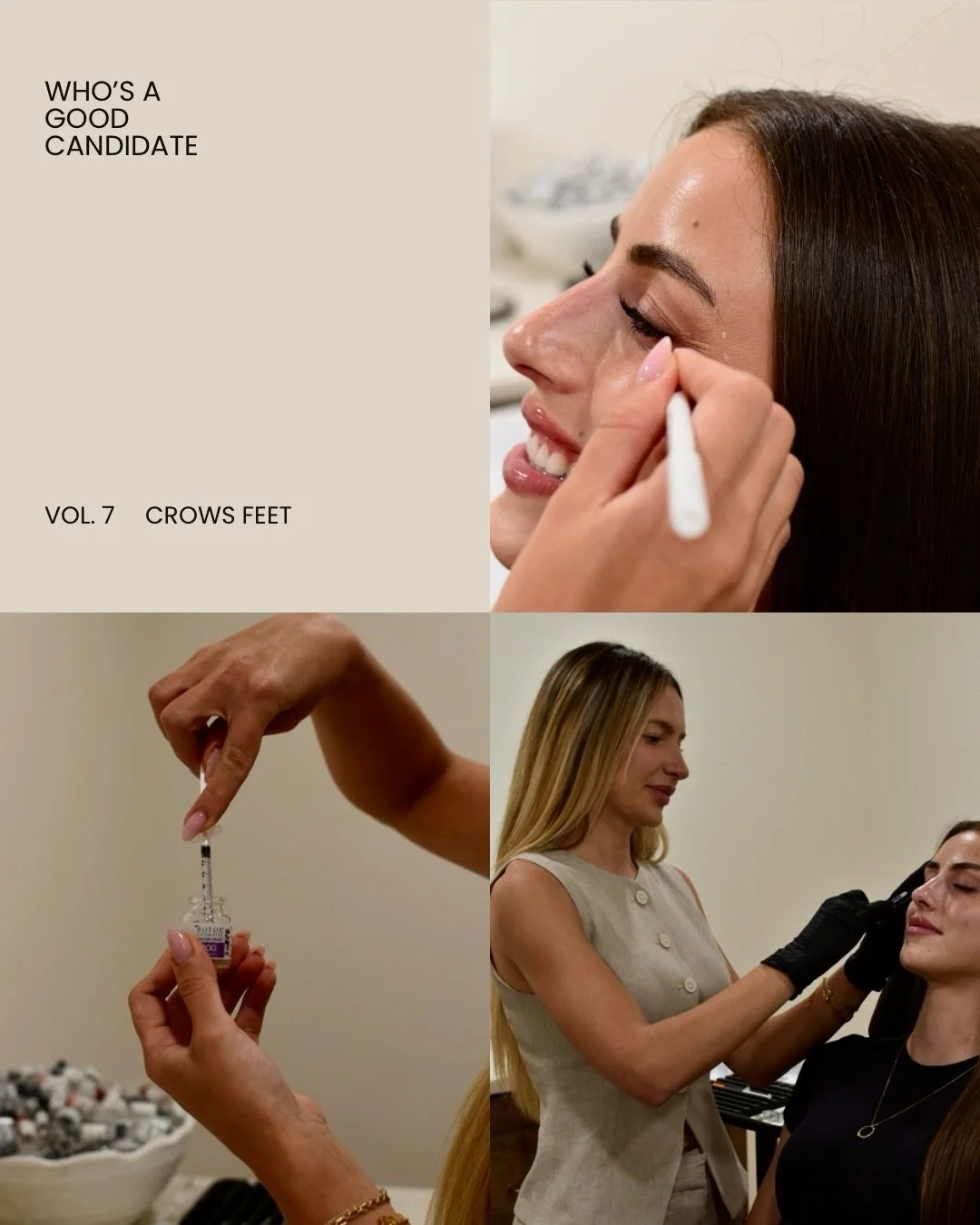 Crow&rsquo;s feet are one of the first things people notice on themselves and on others. And they&rsquo;re one of the most satisfying things we treat. 💉

This is the next installment of our Who&rsquo;s A Good Candidate series, where we break down ex