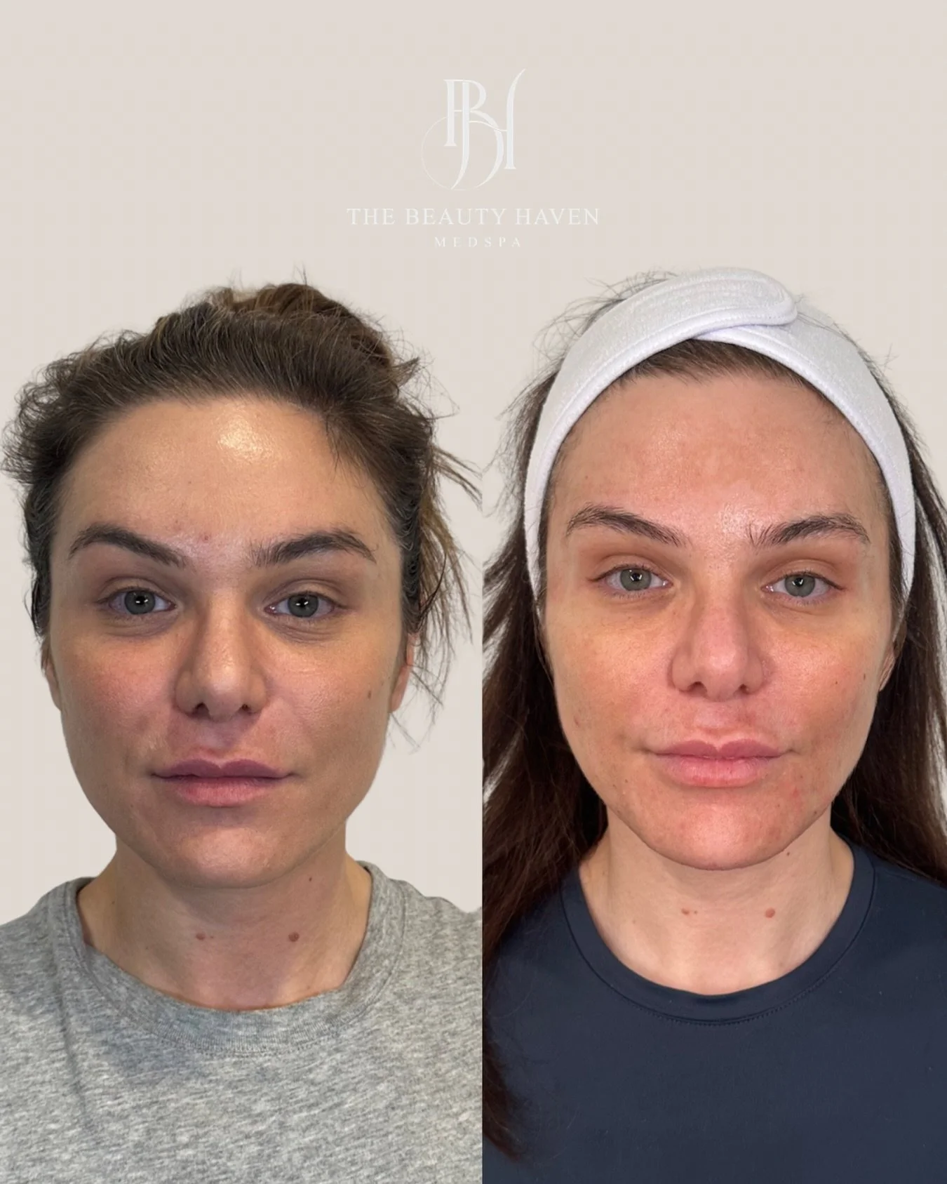 Three years. Every appointment intentional. This is what consistency looks like. 

This result wasn&rsquo;t built overnight and it wasn&rsquo;t built in one appointment. It was built across three years of showing up, trusting the process, and letting