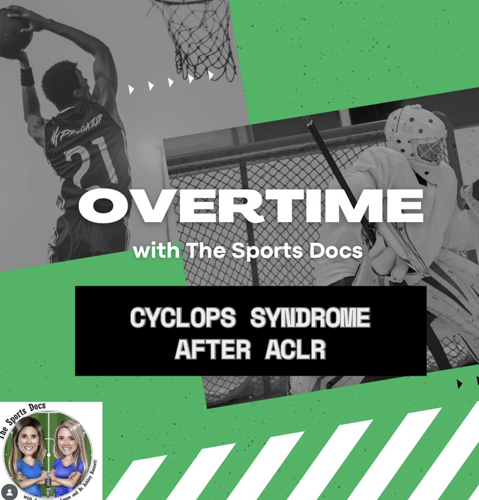 Episode 150: Overtime: Cyclops Syndrome after ACL Reconstruction