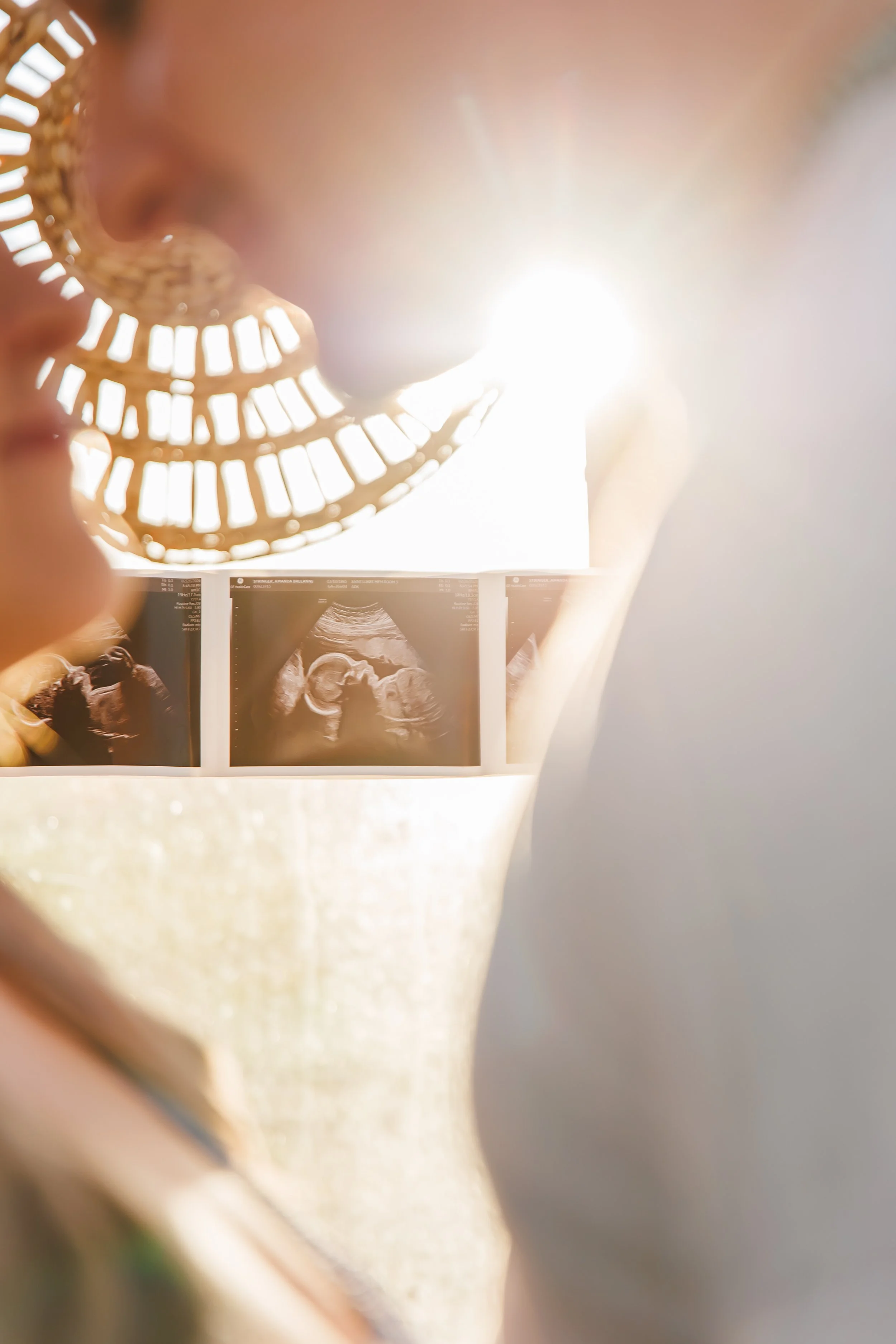 Unborn baby ultrasound images hanging on a wall, with a person holding a circular object and sunlight shining through.