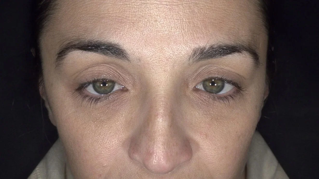 Murad - puffy eyes - dark under eyes - tired eyes - eye care - crows feet - cosmetic clinic geraldton - REJURAN
