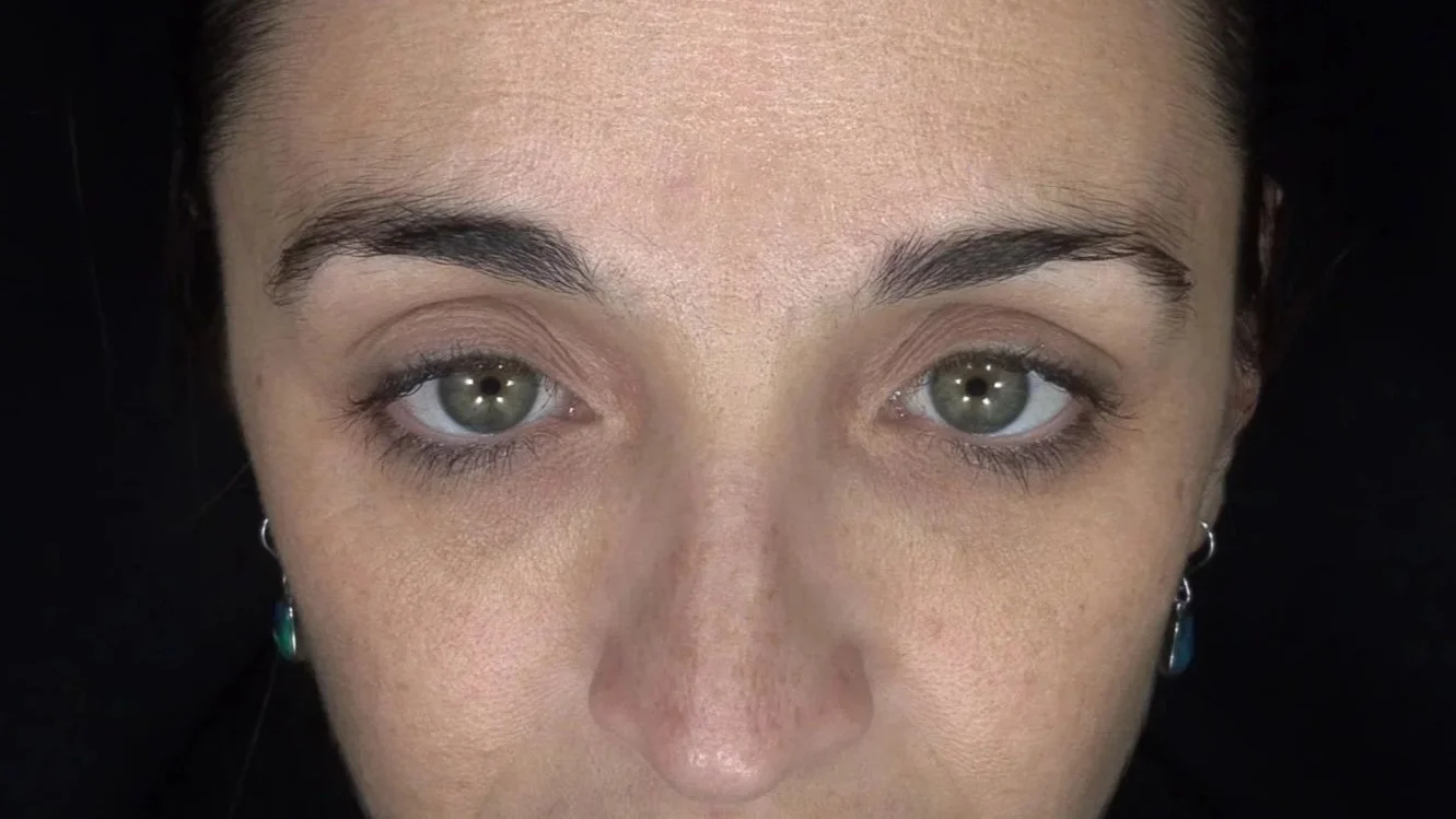 Murad - puffy eyes - dark under eyes - tired eyes - eye care - crows feet - cosmetic clinic geraldton - REJURAN