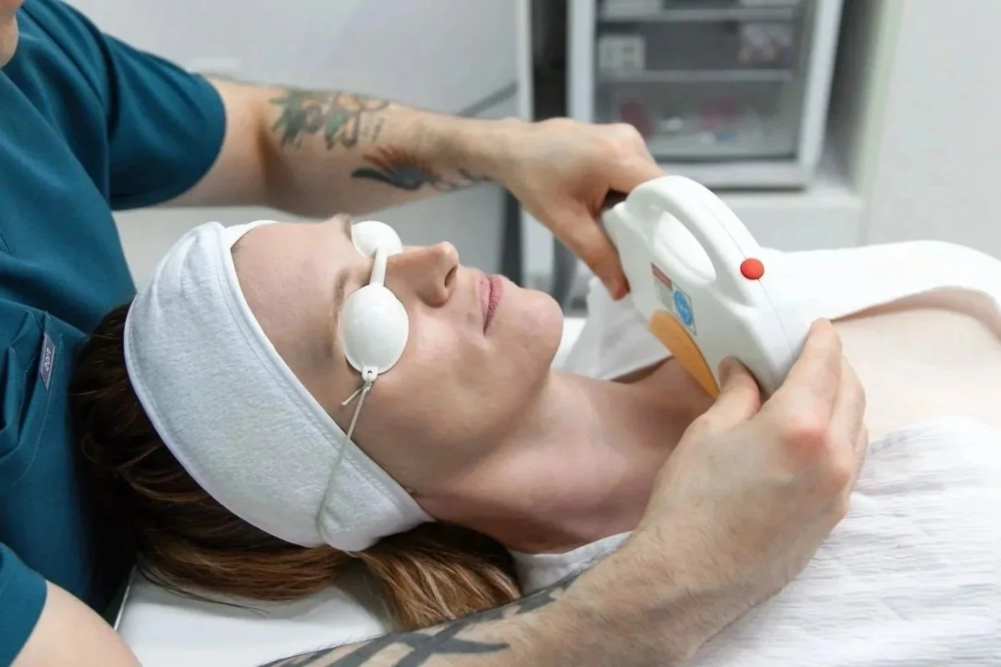 IPL vascular therapy - broken capillaries - cherry angiomas - spider veins - collagen production - elastin production - glowing skin - fine lines and wrinkles - skin treatments - skin clinic - cosmetic clinic - geraldton - pure cosmetics