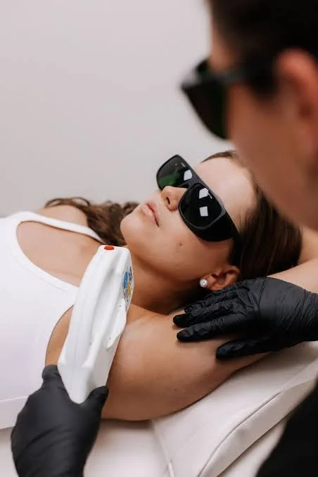 hair removal - IPL - laser - geraldton