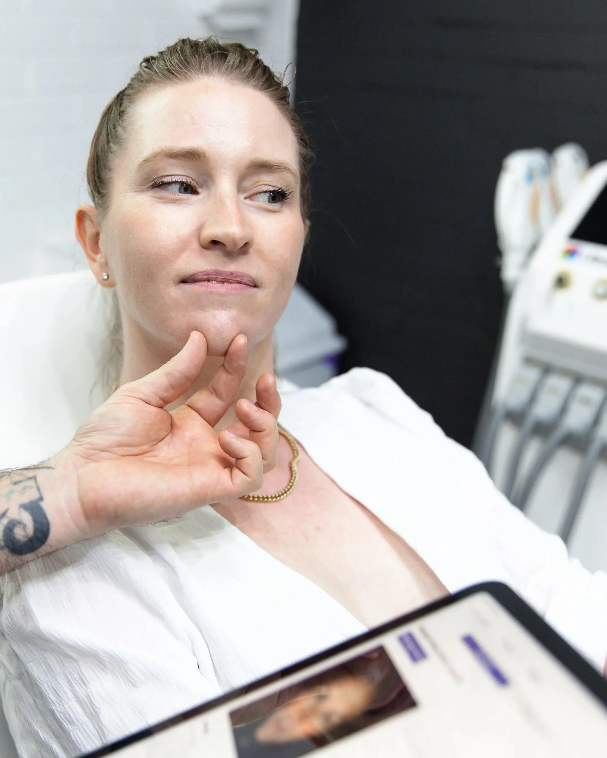 dermal filler - chin filler - jawline filler - jowls - nasolabial folds - - skin treatment - skin clinic - cosmetic clinic - geraldton - pure cosmetics