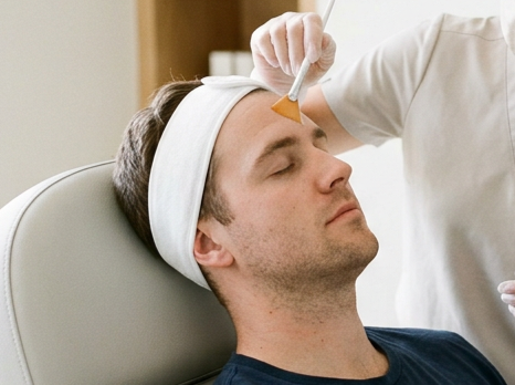 Chemical peel - exfoliation - skin clinic - aesthetics - medical - geraldton