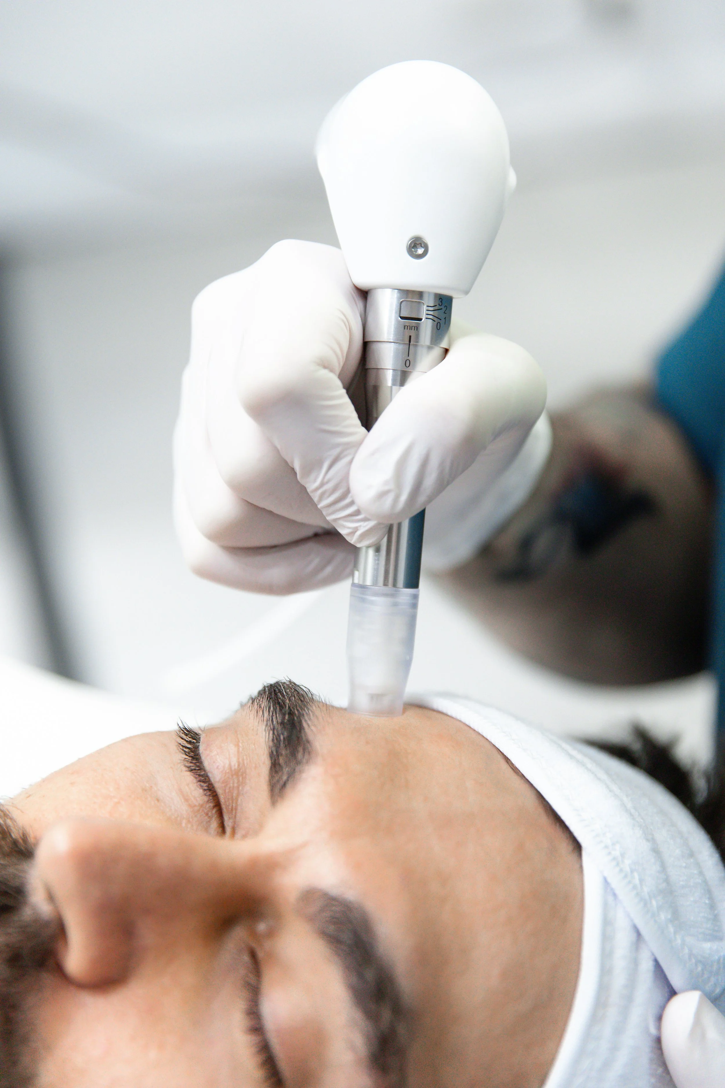 skin needling - microneedling - exfoliating - dry skin - skin treatment - skin clinic - cosmetic clinic - geraldton - pure cosmetics