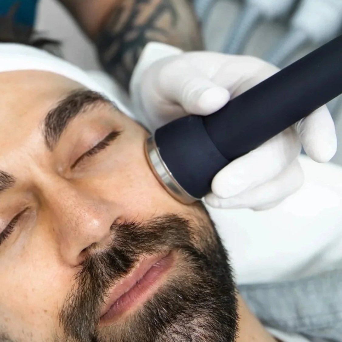 sonophoresis - skin infusions - hydration - exfoliating - dry skin - skin treatment - skin clinic - cosmetic clinic - geraldton - pure cosmetics