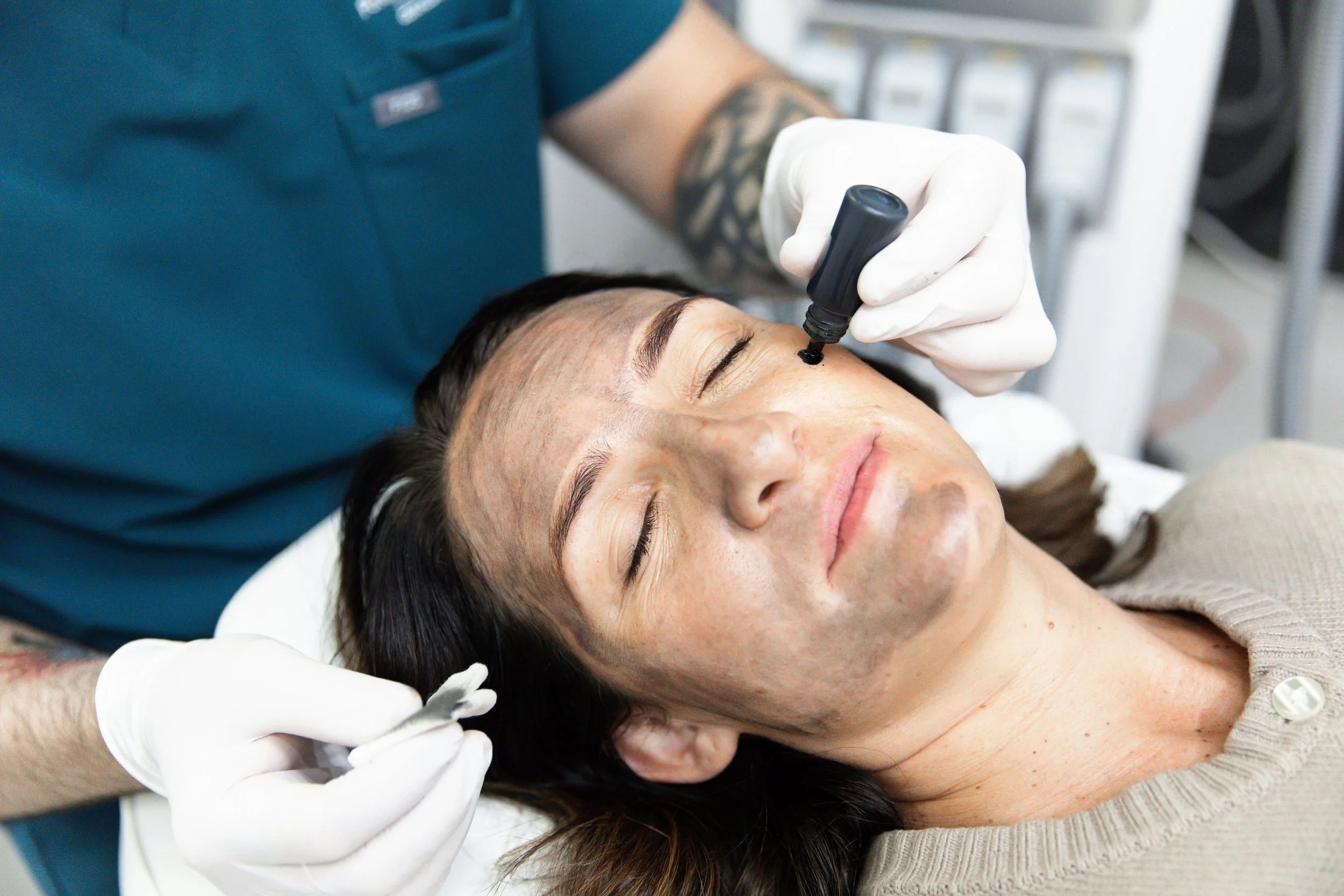 advanced rejuvenation package - carbon laser peel - collagen production - elastin production - glowing skin - skin treatment - skin clinic - cosmetic clinic - geraldton - pure cosmetics