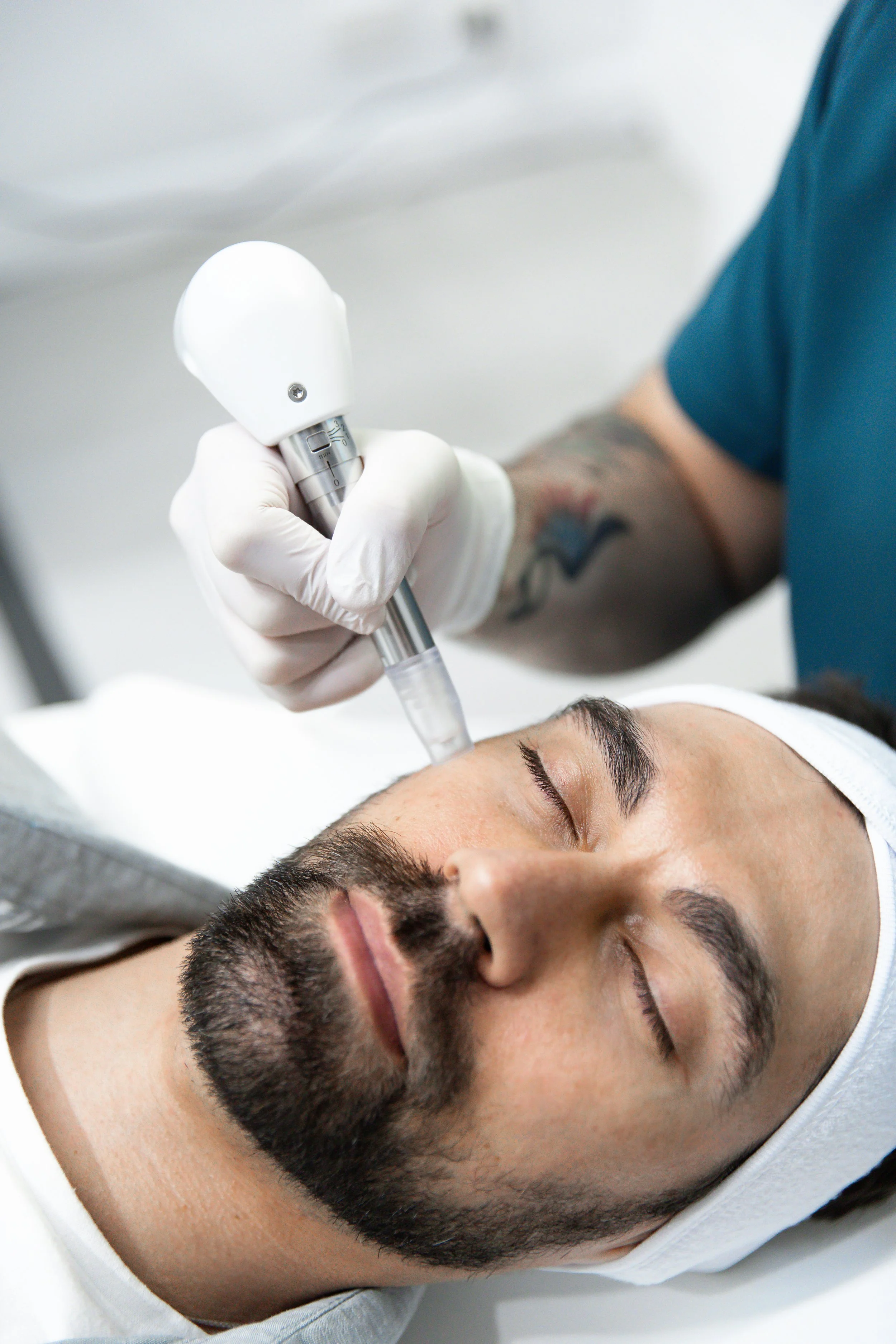 skin needling - microneedling - collagen induction therapy - skin treatments - skin clinic - cosmetic clinic - geraldton - pure cosmetics