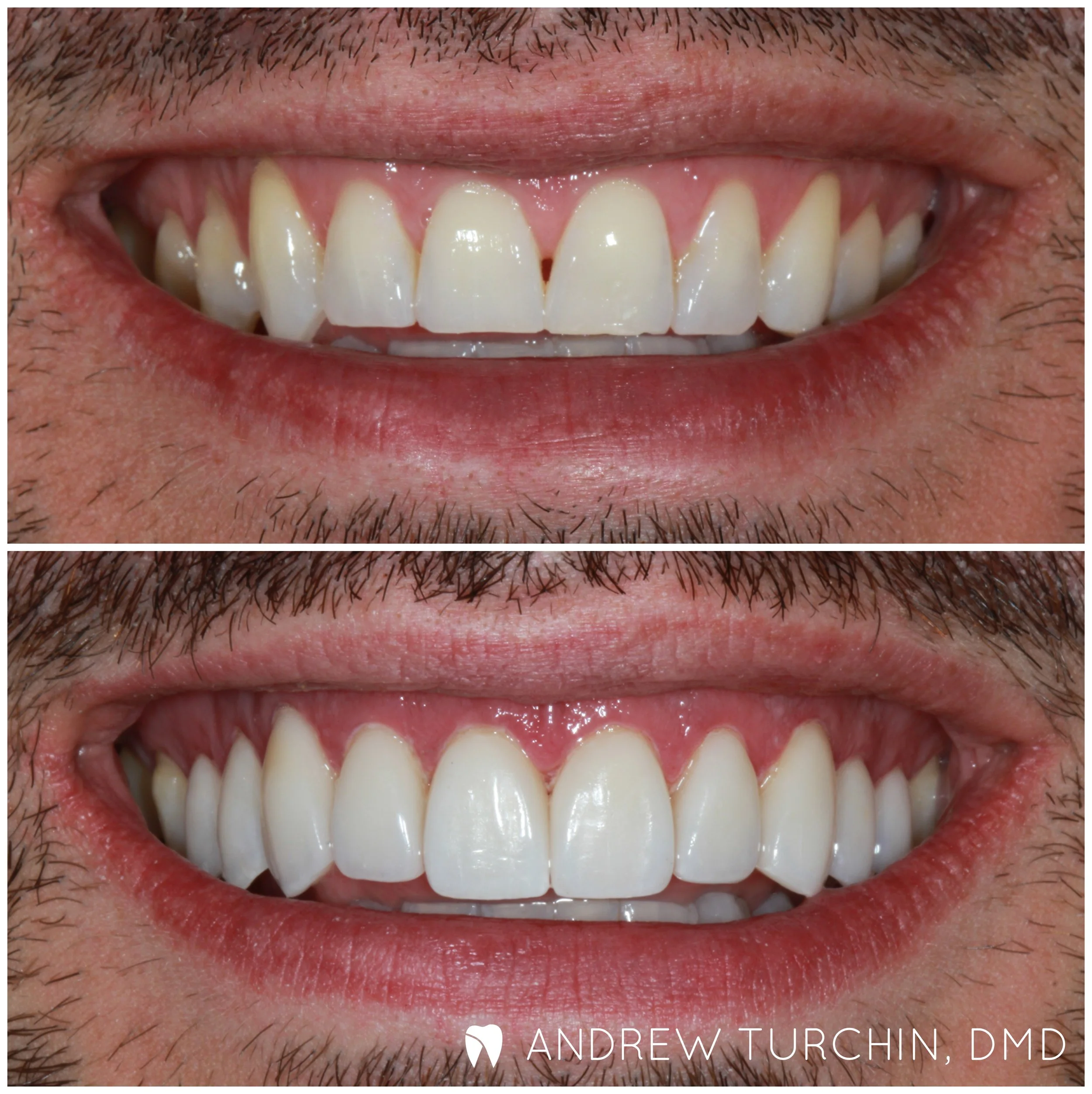 JA b&a wm.jpg