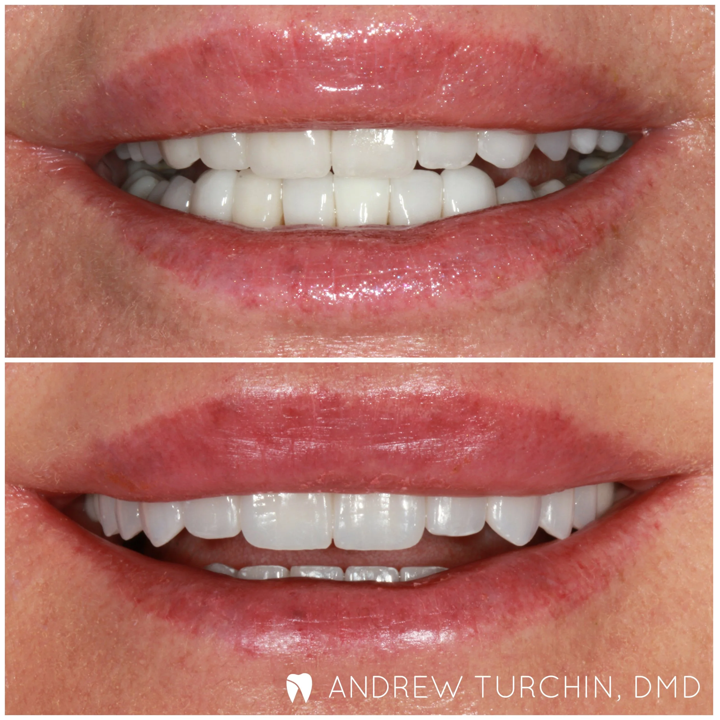 Andew Turchin aspen CO dentist KG B&A wm.jpg