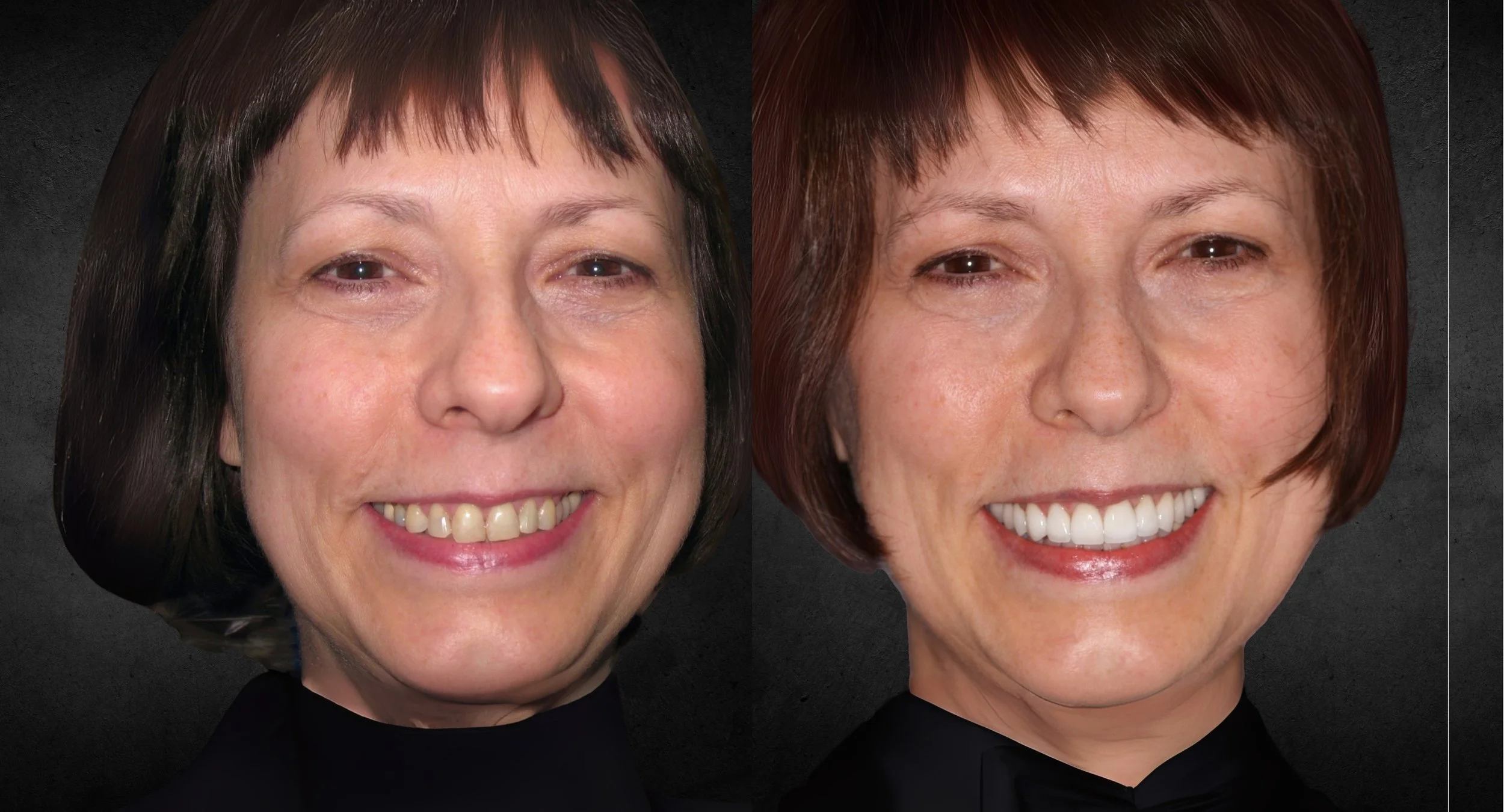 CCC  Full Face B&A.jpg