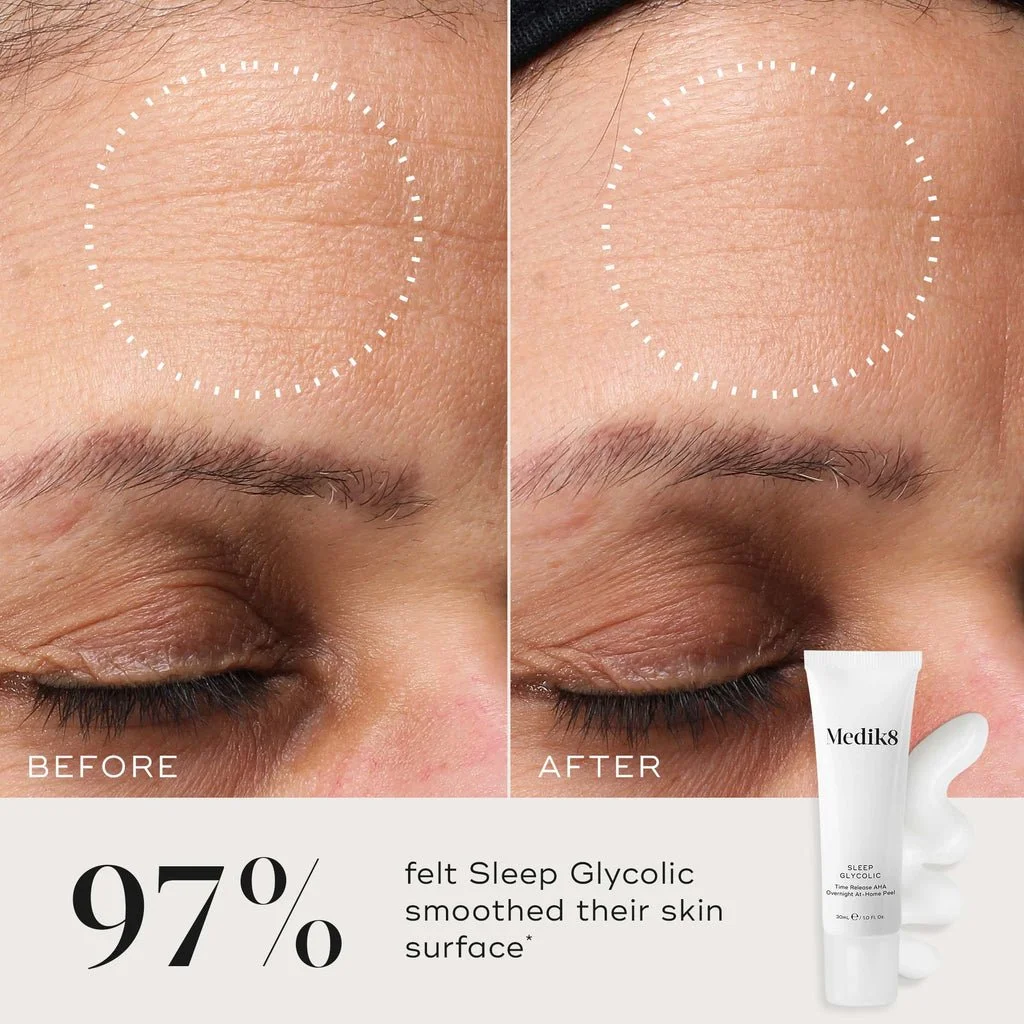 SLEEP GLYCOLIC AT HOME PEEL BEFORE AND AFTER.jpeg