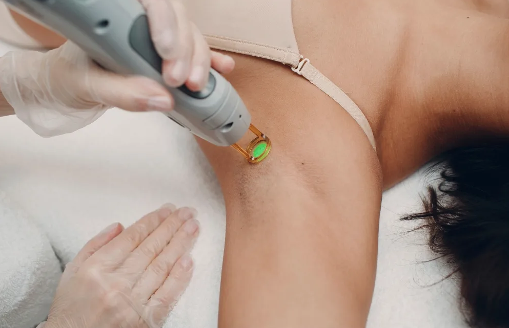 A person receiving laser hair removal on their leg in a clinical setting