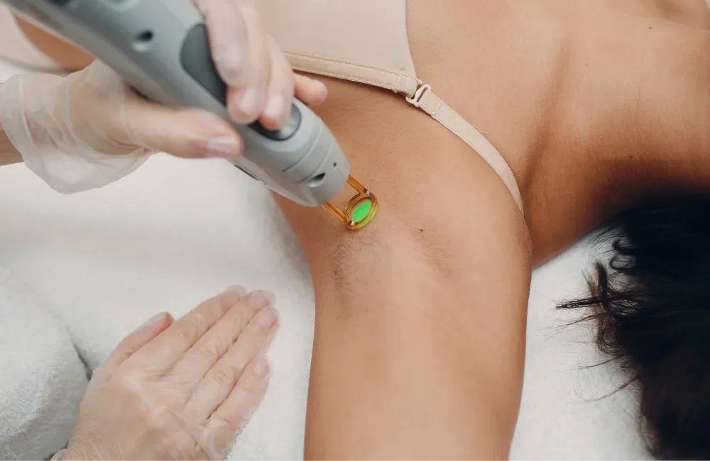 Laser Hair Removal