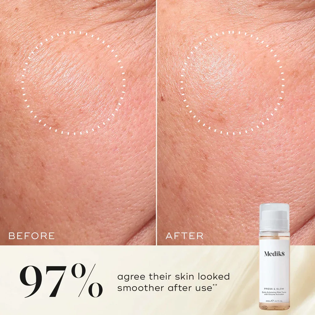 Press_Glow BEFORE AND AFTER.webp