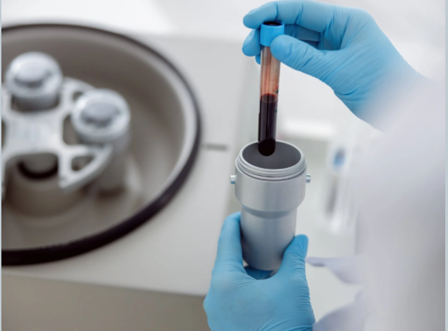 Platelet Rich Plasma Therapy (PRP)