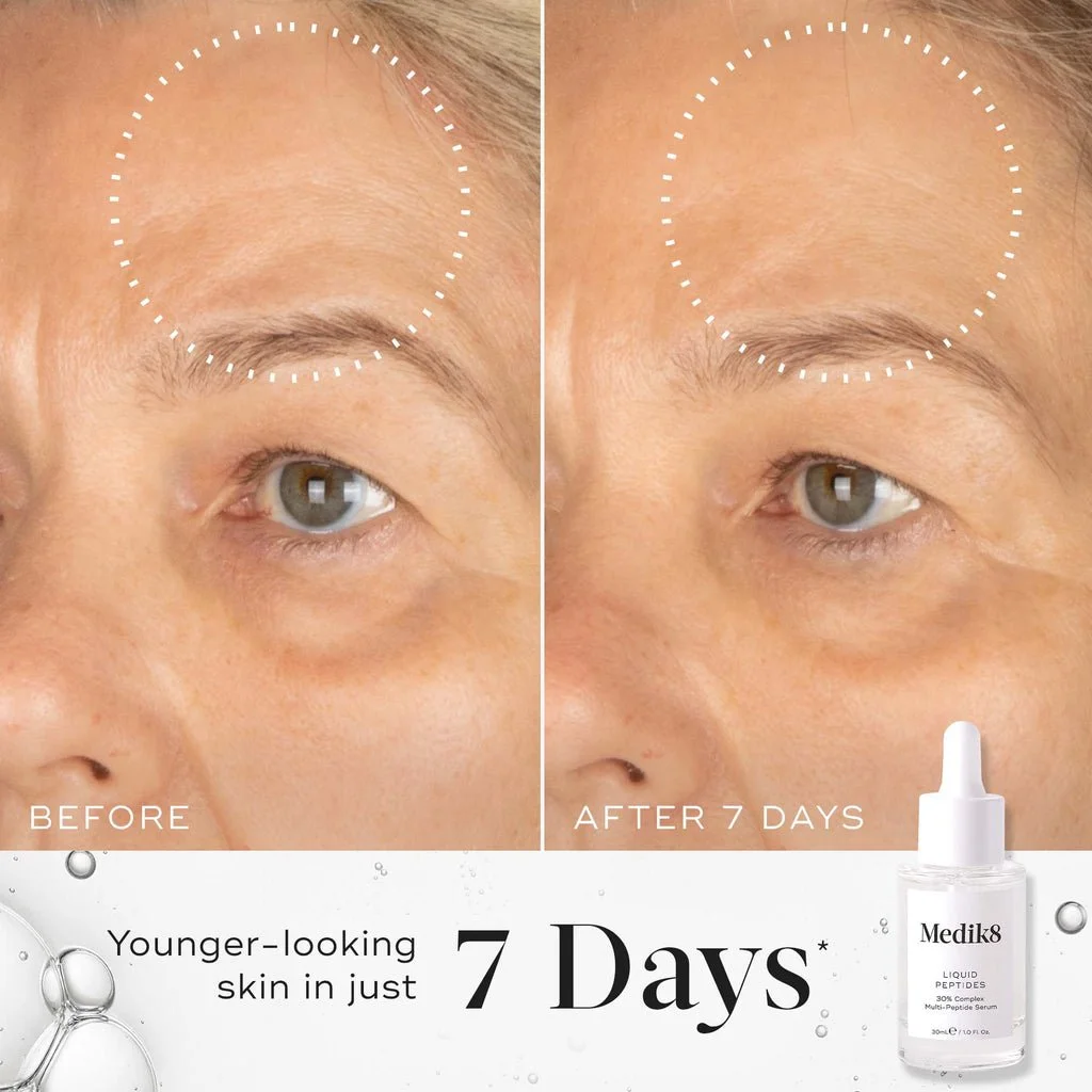 LIQUID PEPTIDES BEFORE AND AFTER RESULTS IN 7 DAYS.jpeg