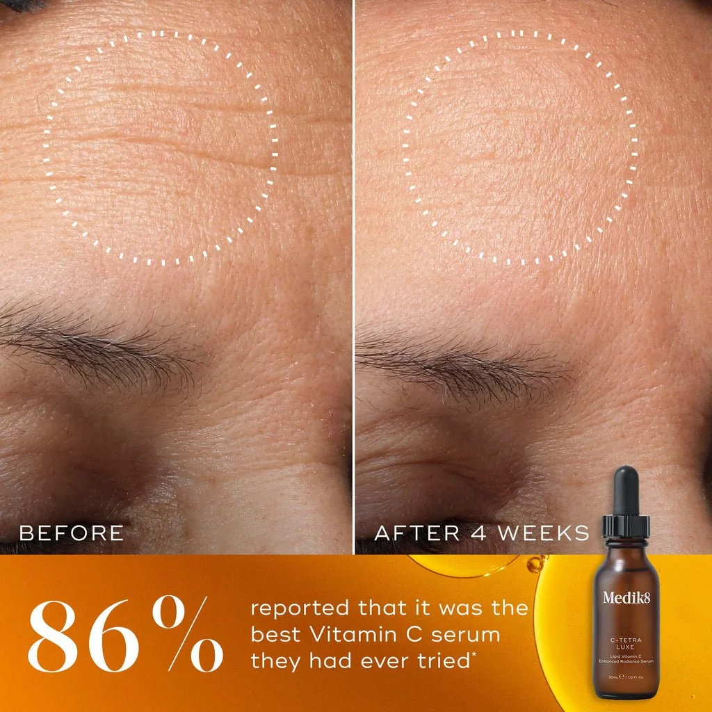 C-TETRA LUXE VITAMIN C SERUM BEFORE AND AFTER RESULTS.jpeg