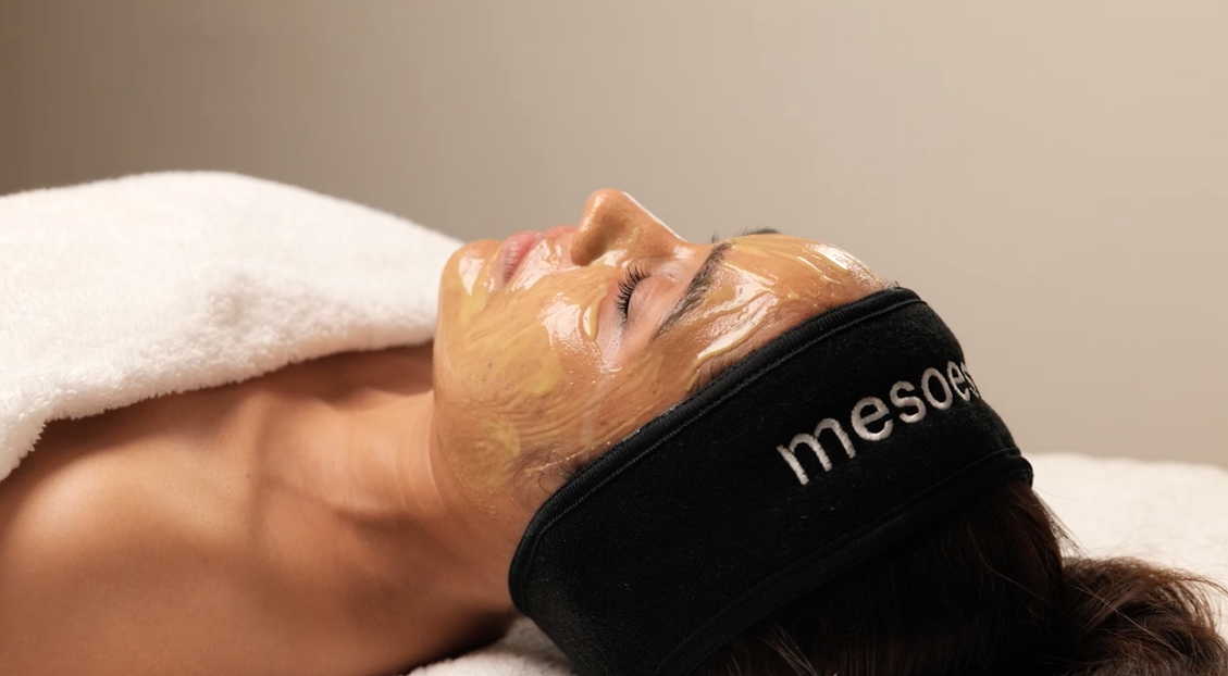 Close up of woman's face getting chemical peel