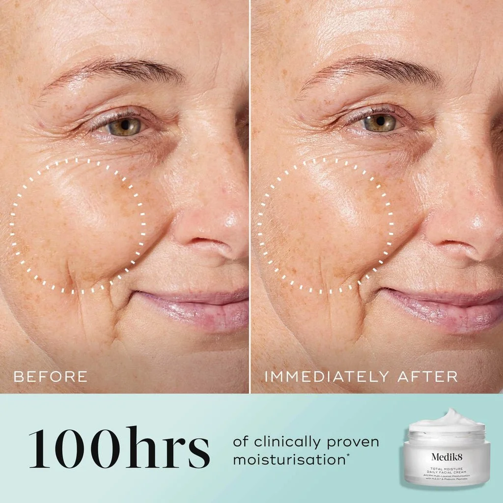 TOTAL MOISTURE DAILY FACIAL CREAM BEFORE AND AFTER.jpeg