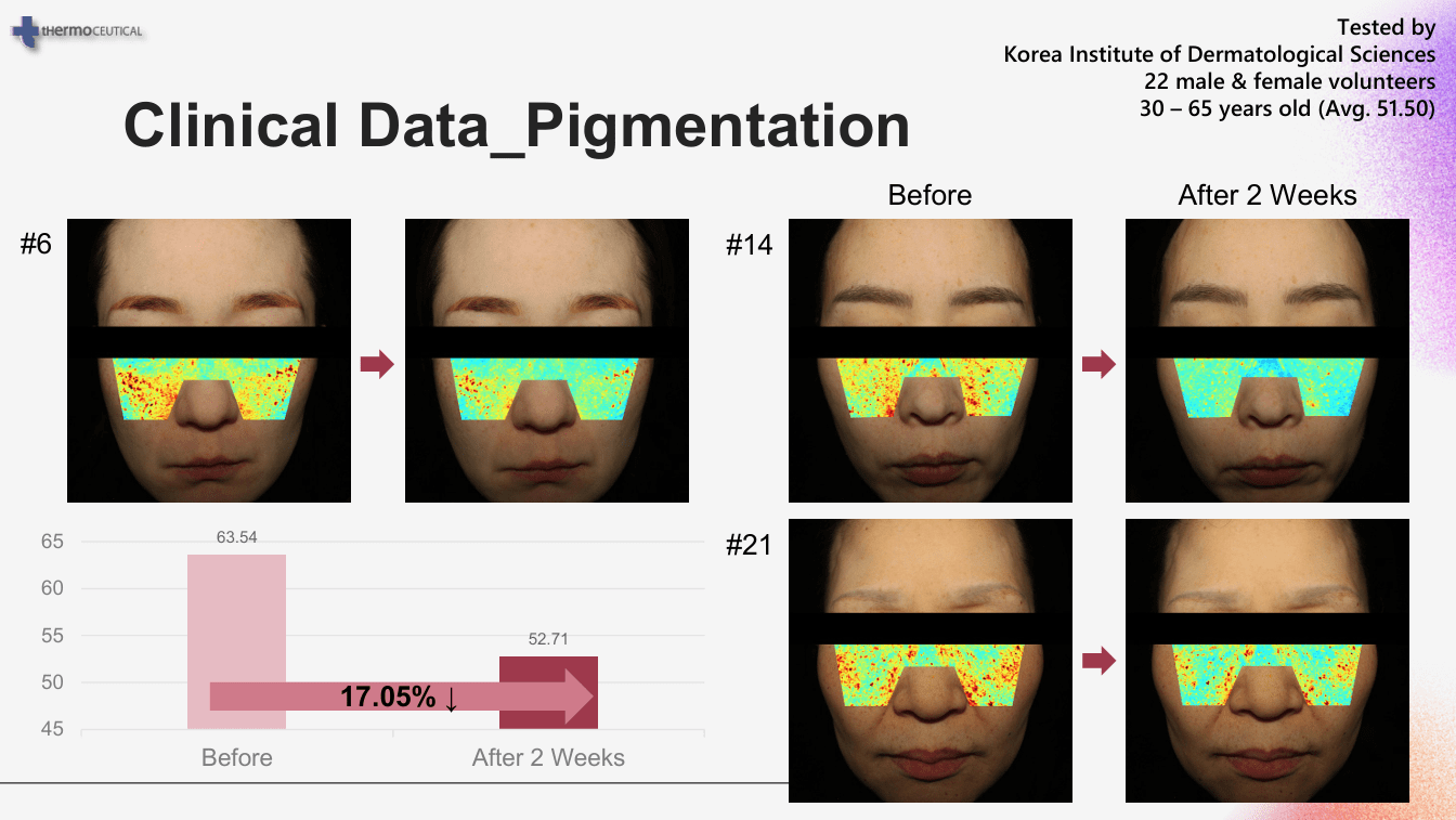 Clinical data on pigmentation showing before and after images of two women, with color-coded pigmentation maps and a bar graph indicating a 17.05% reduction in pigmentation after two weeks of treatment tested by Korea Institute of Dermatological Sciences.