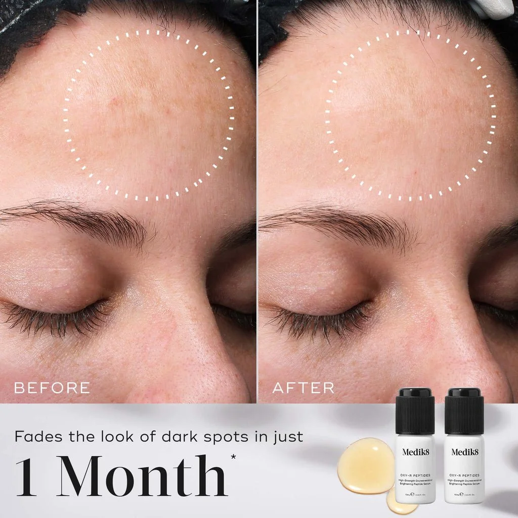 OXY-R PEPTIDES BEFORE AND AFTER REDUCE SUN DAMAGE PIGMENTATION.jpeg