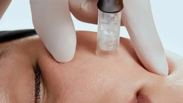 Hydra Facial