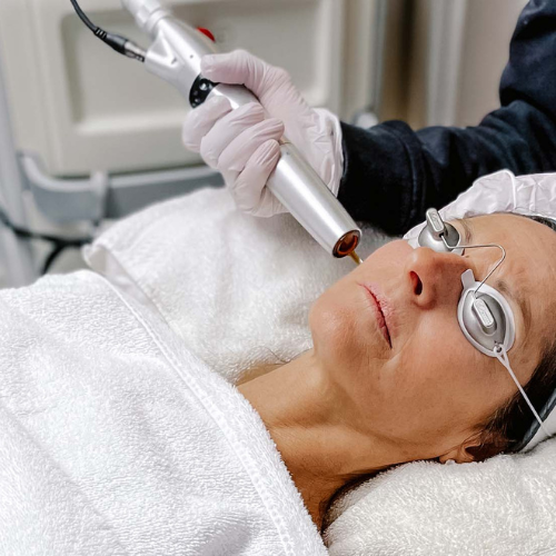 PicoWay picosecond laser pigmentation and dark spot removal Visage Skin Clinique Sudbury