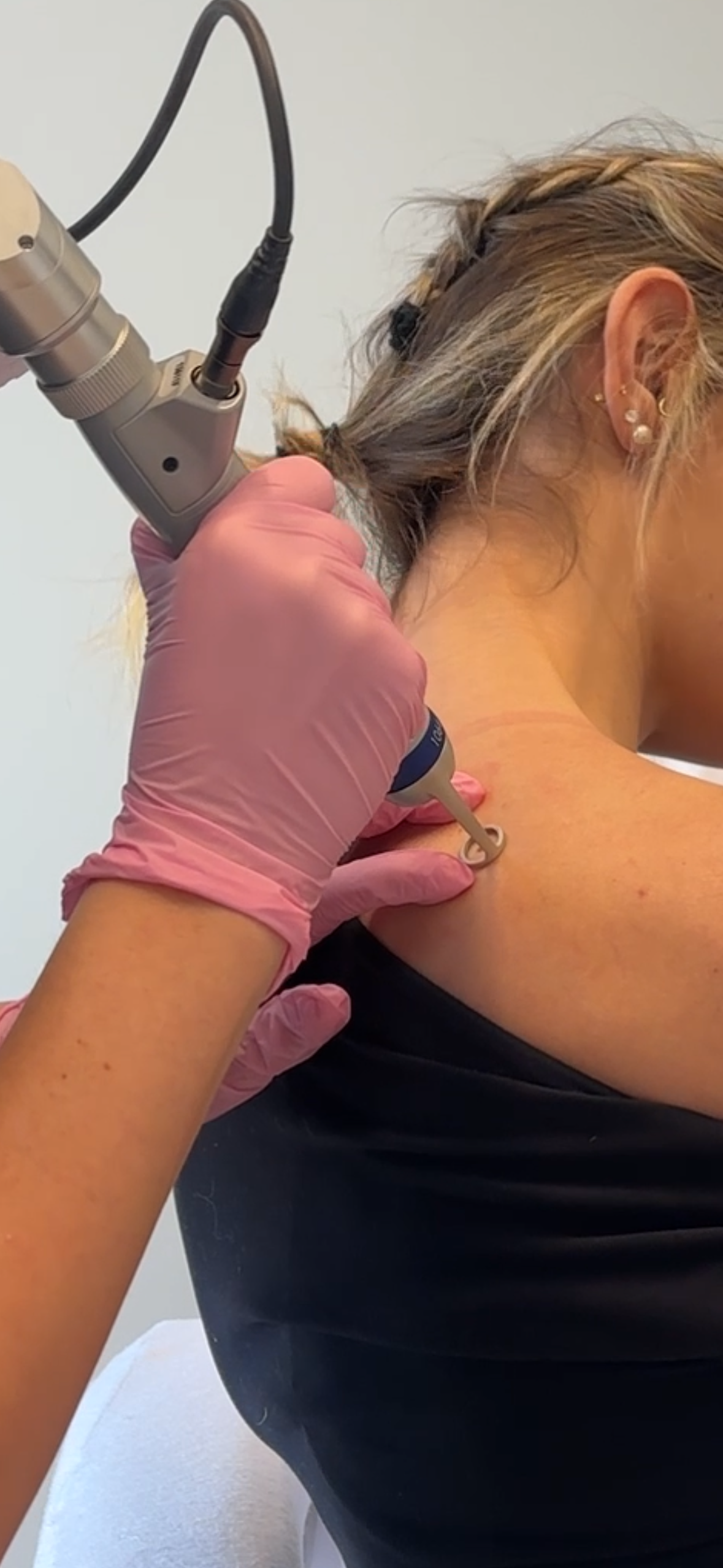 Advanced anti-aging facial rejuvenation using PicoWay laser technology Visage Skin Clinique Sudbury Ontario