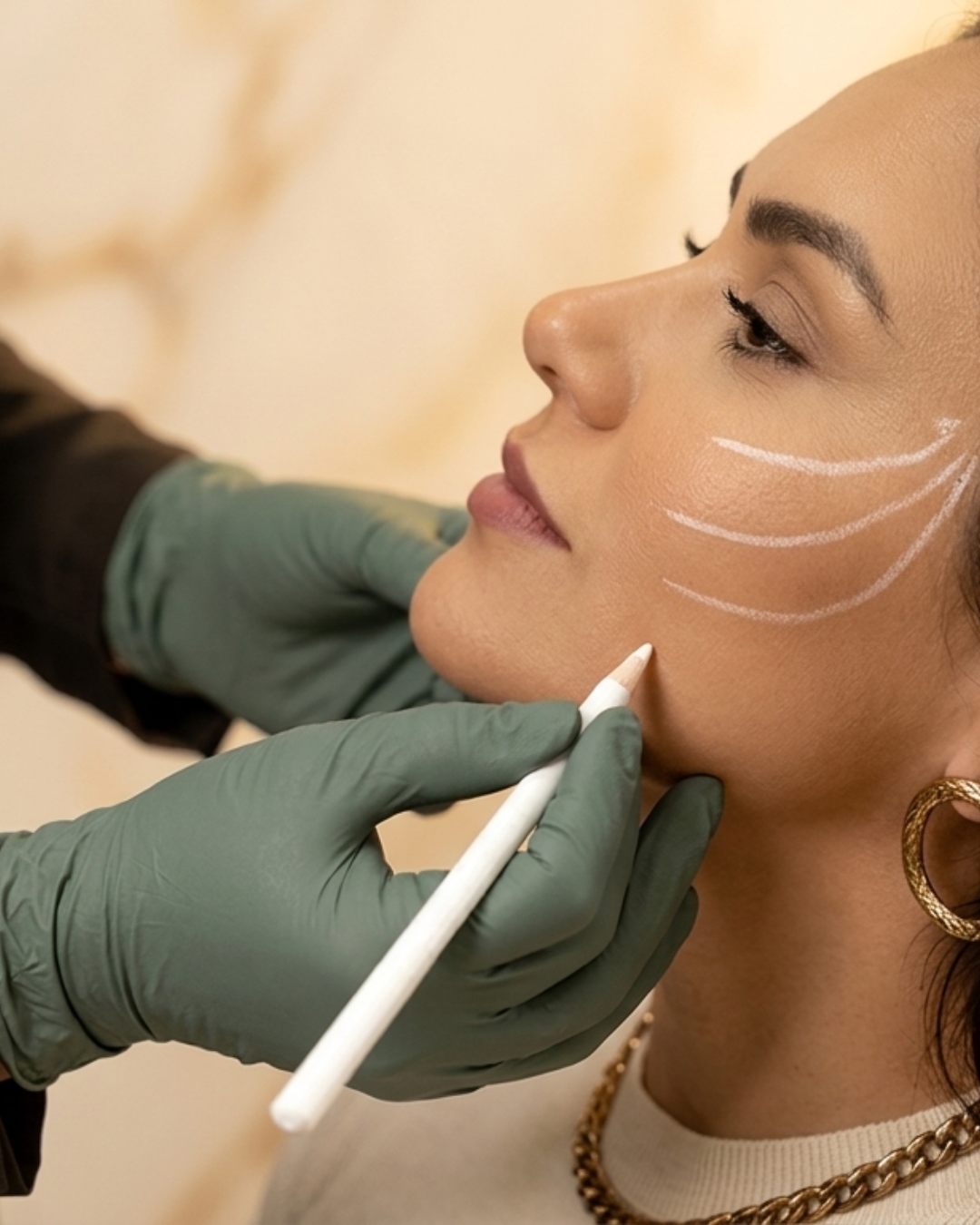 Medical-grade injectable treatment performed with surgical precision at Visage Skin Clinique Sudbury