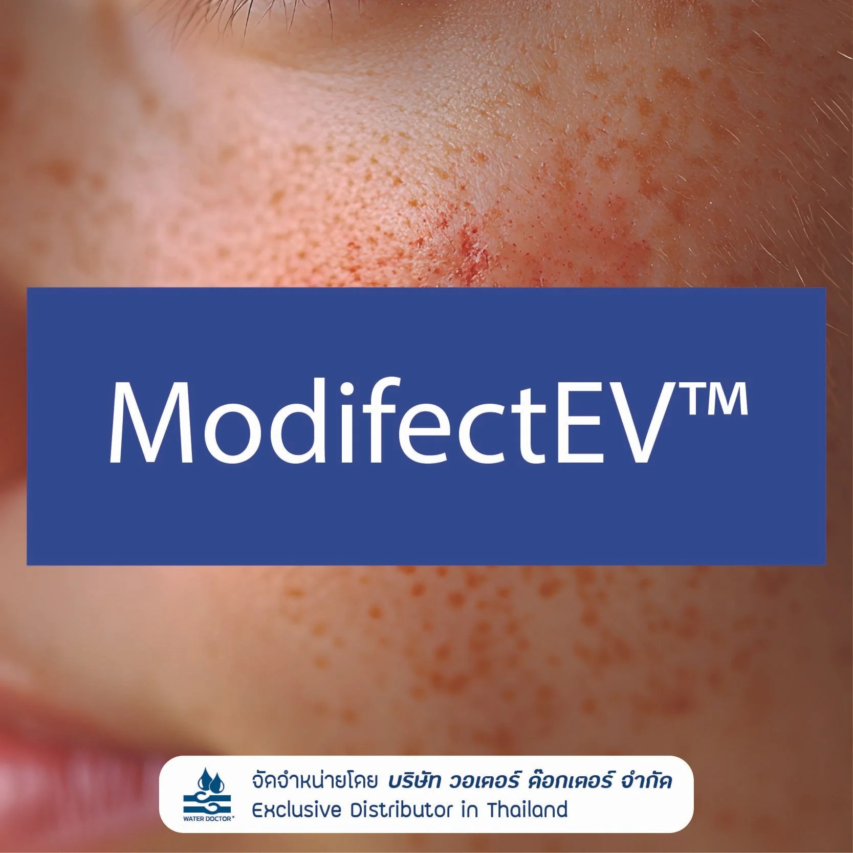 ModifectEV วัตถุดิบช่วยดูแลผิว ช่วยลดเลือนลักษณะของ จุดด่างดำและริ้วรอย