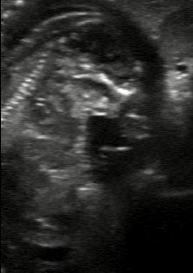 Ultrasound image of a developing hedgehog fetus inside the womb.