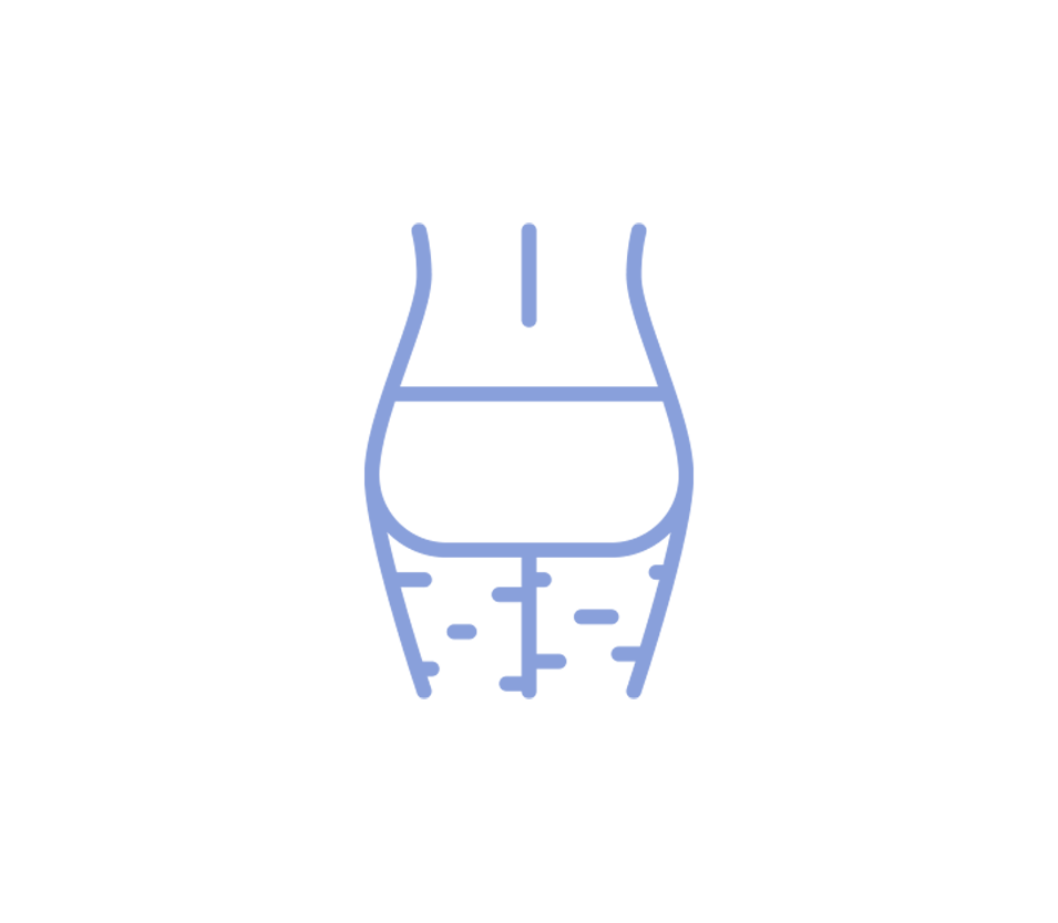 cellulite2.png