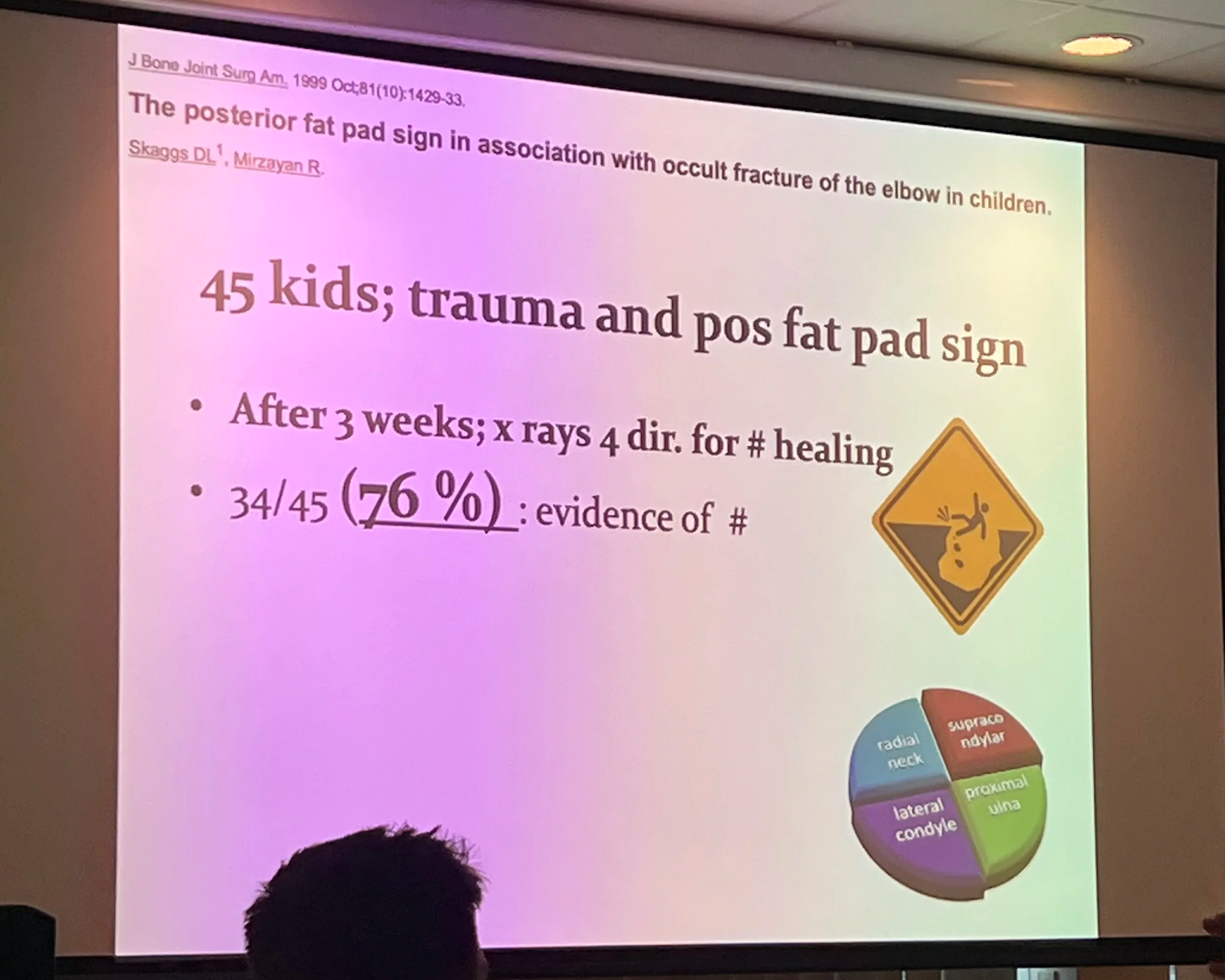 X-ray fat pad sign in children indicating possible elbow fracture