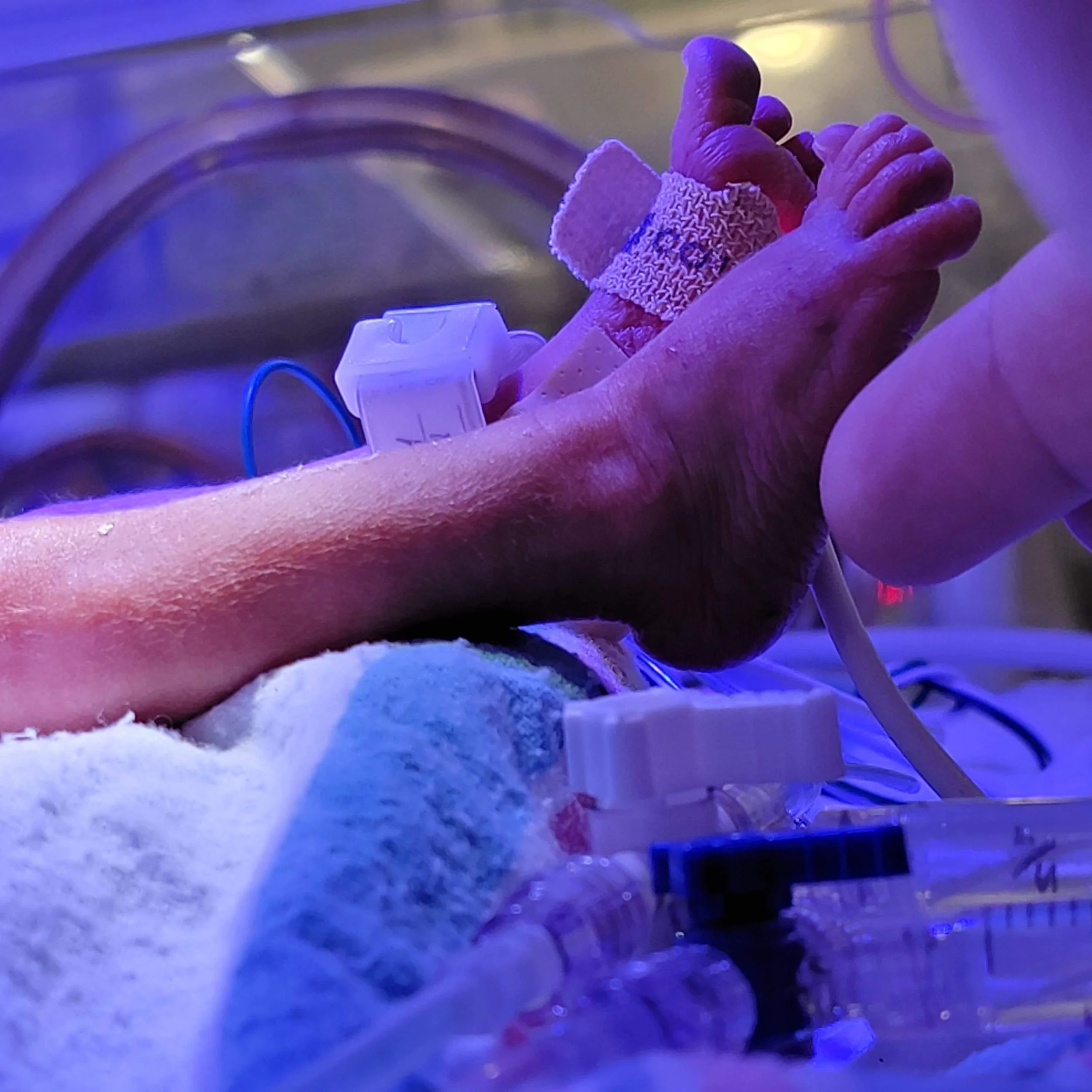 Why Am I Still Anxious After My Baby Came Home From the NICU?