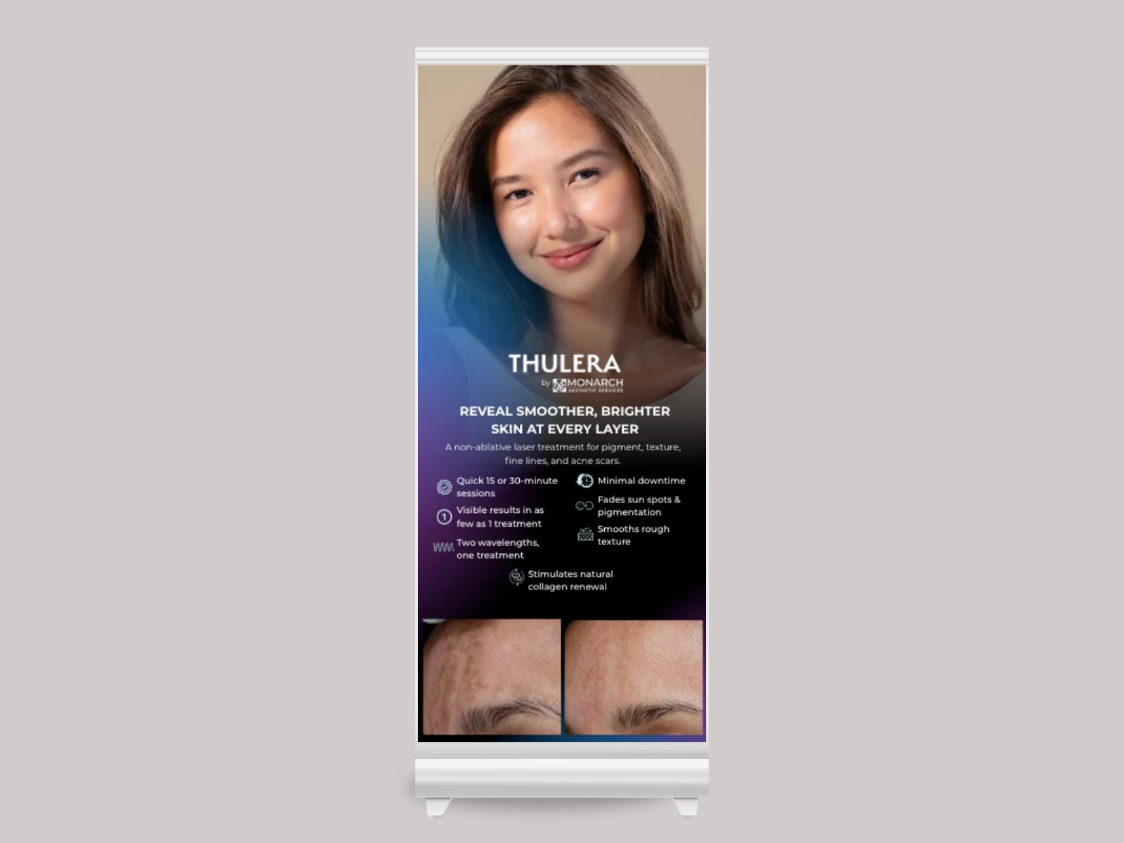 Patient Pop Up Banner