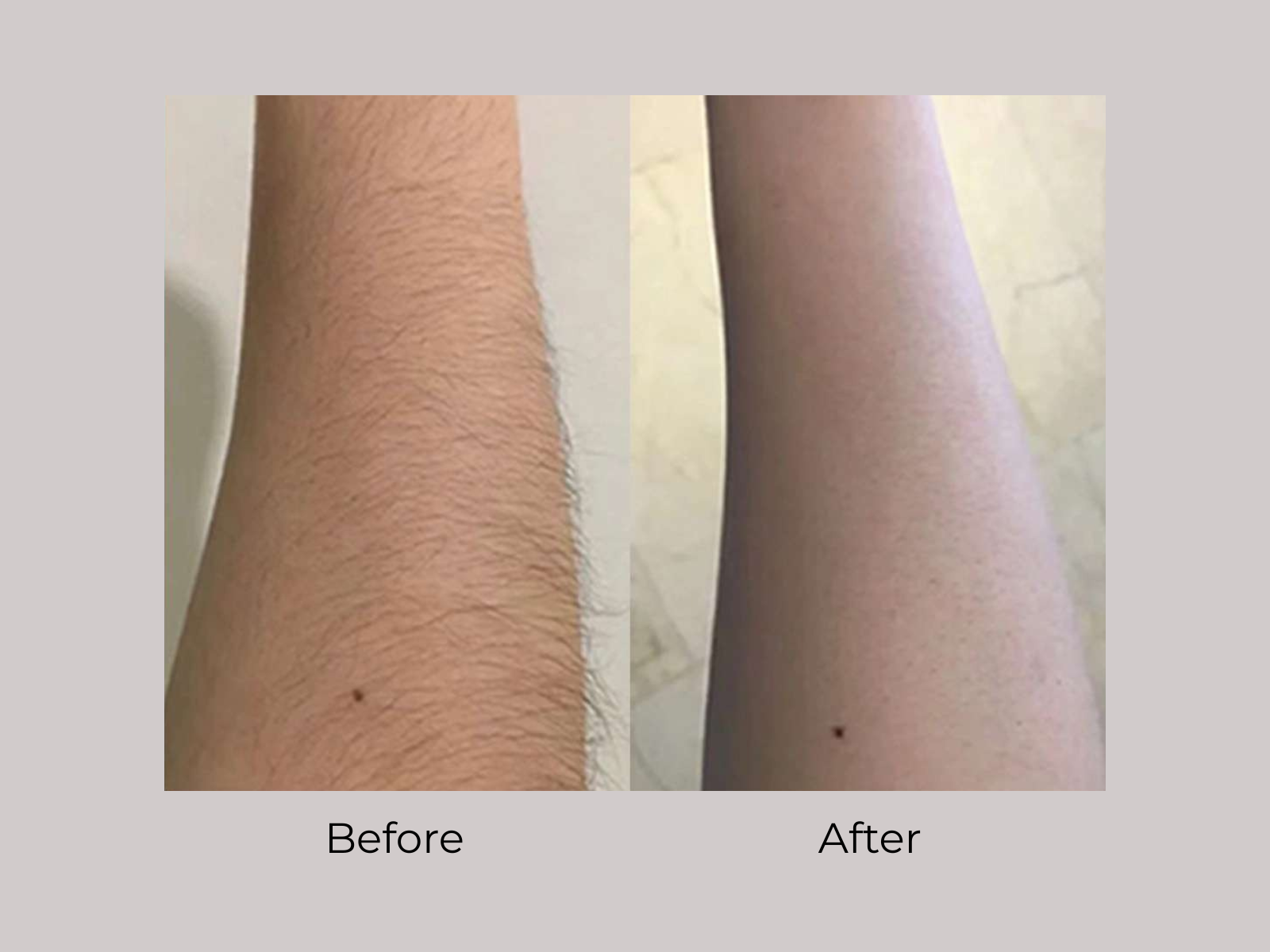 Aura365 Before and After Images