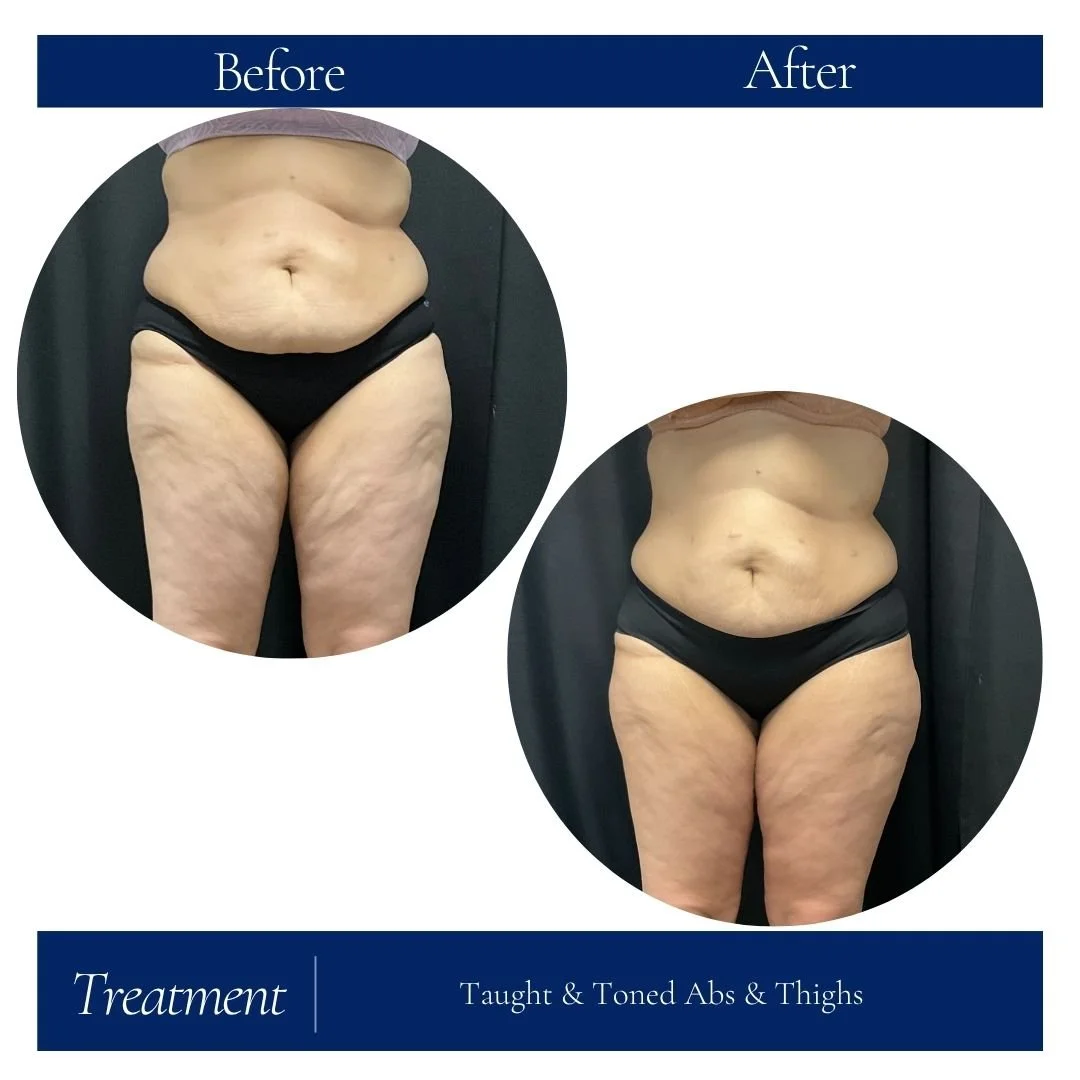 T&T 38yr old female.jpg
