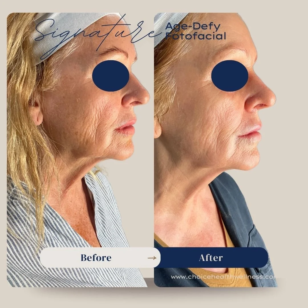70yr old female sig age defy (2).jpg