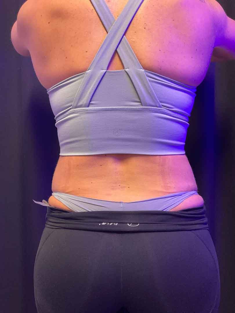 B-Emsculpt-Jessica-Pena-1.jpg